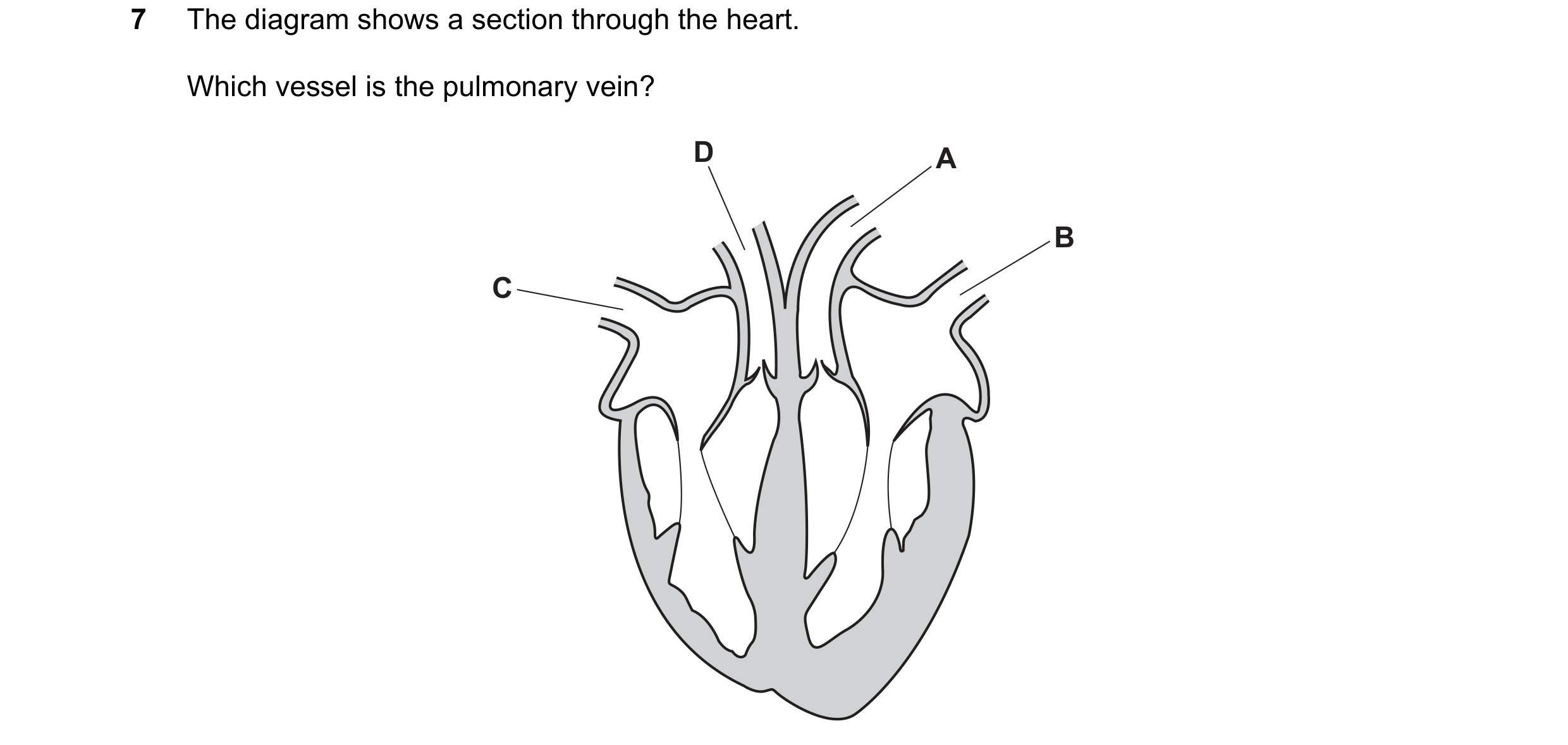 Question 63: The diagram shows a section through the heart. Which vessel is the pulmonary vein? D A B C