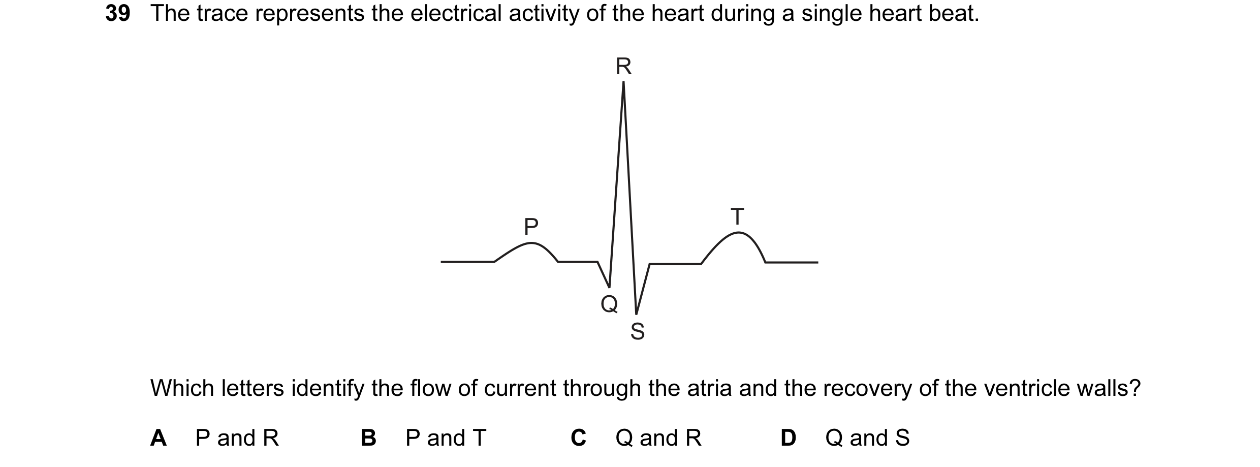 Question 12: The trace represents the electrical activity of the heart during a single heart beat. R T P Q S Which letters identify the flow of current …