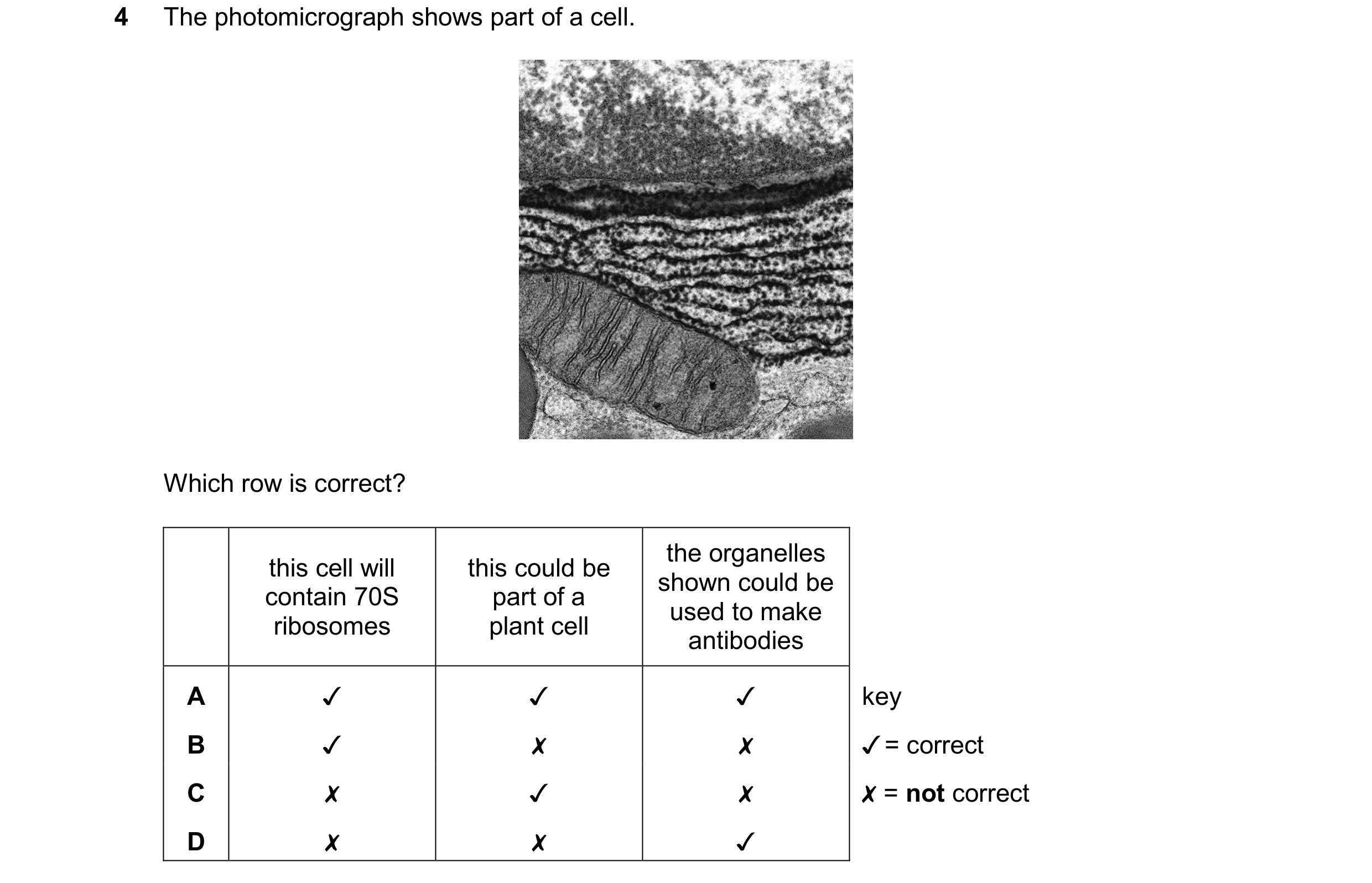 Question 157: The photomicrograph shows part of a cell.

Which row is correct?

the organelles

this cell will this could be | shown could be
contain 70S…
