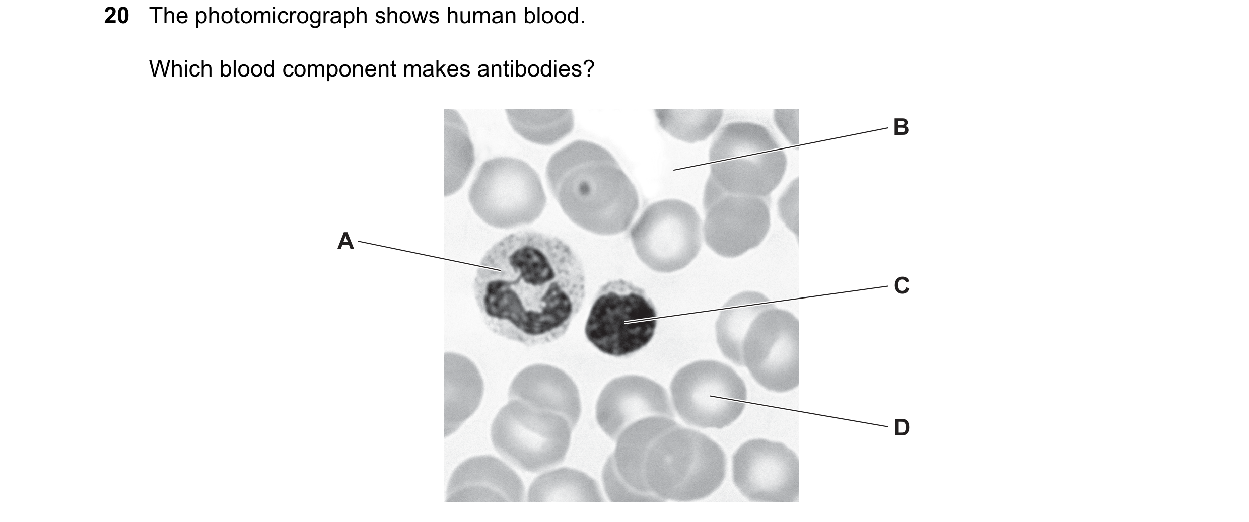 Question 15: The photomicrograph shows human blood. Which blood component makes antibodies? B A C D