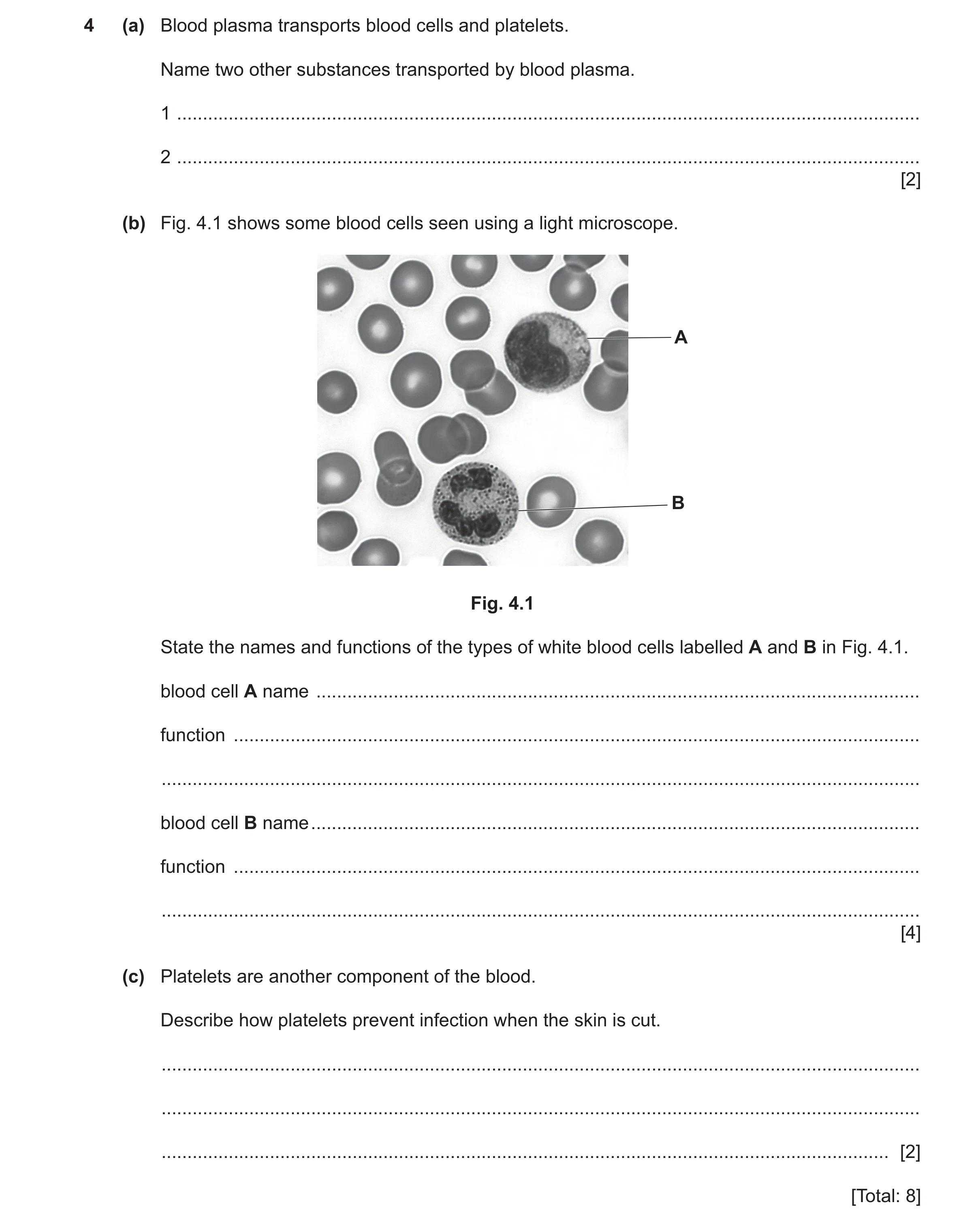 Question 14: (a) Blood plasma transports blood cells and platelets. Name two other substances transported by blood plasma. 1 ...........................…