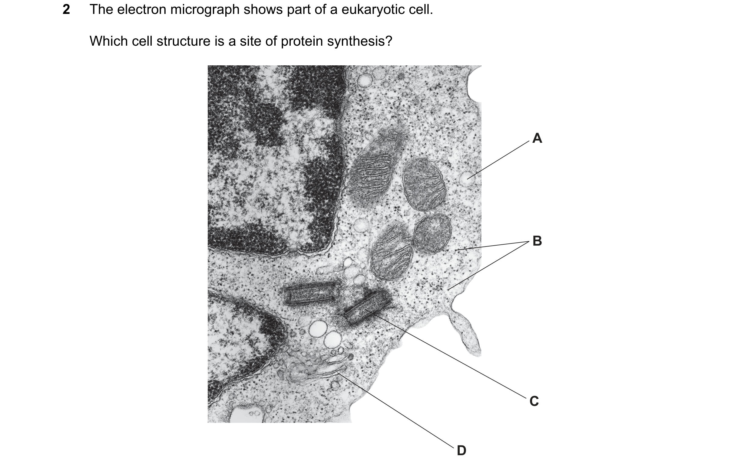 Question 245: The electron micrograph shows part of a eukaryotic cell. Which cell structure is a site of protein synthesis? A B C D
