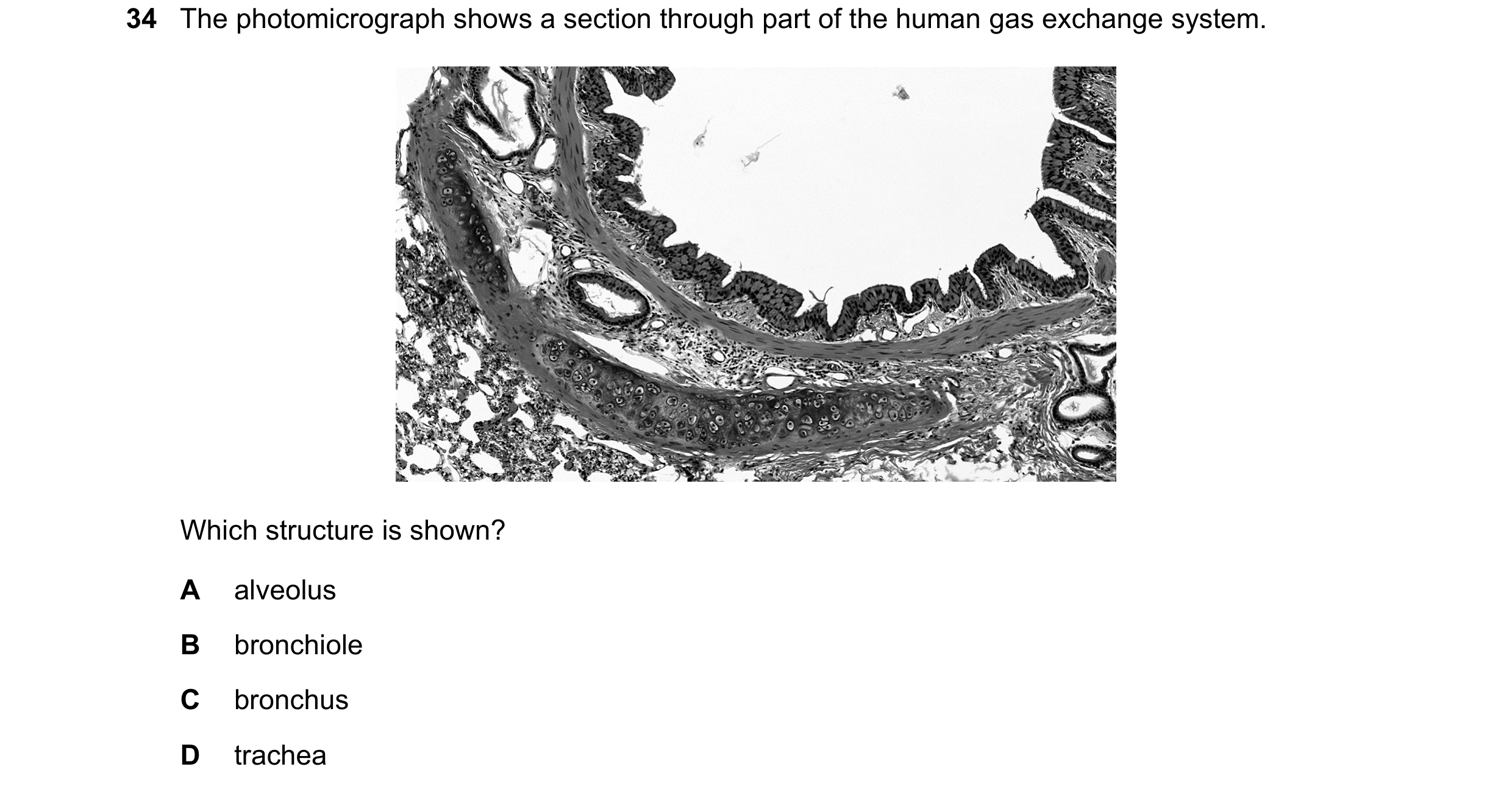 Question 236: The photomicrograph shows a section through part of the human gas exchange system. Which structure is shown? A alveolus B bronchiole C bron…