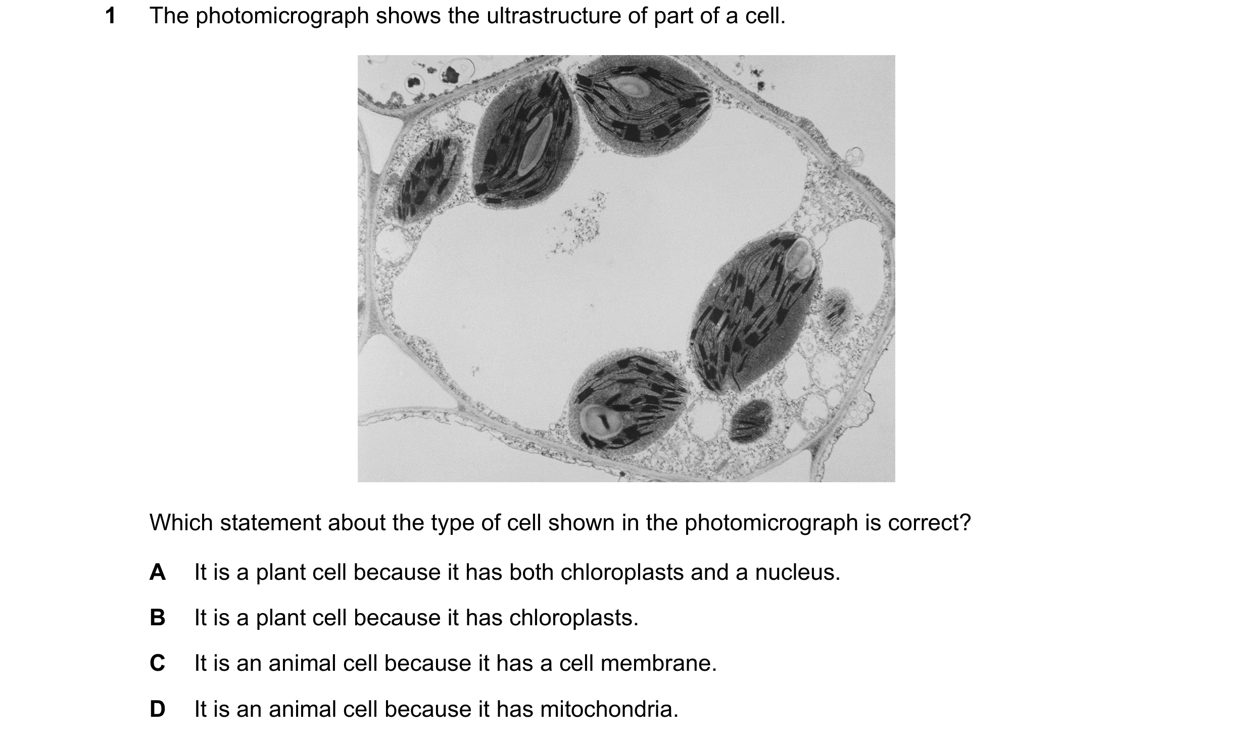 Question 238: The photomicrograph shows the ultrastructure of part of a cell. Which statement about the type of cell shown in the photomicrograph is corr…