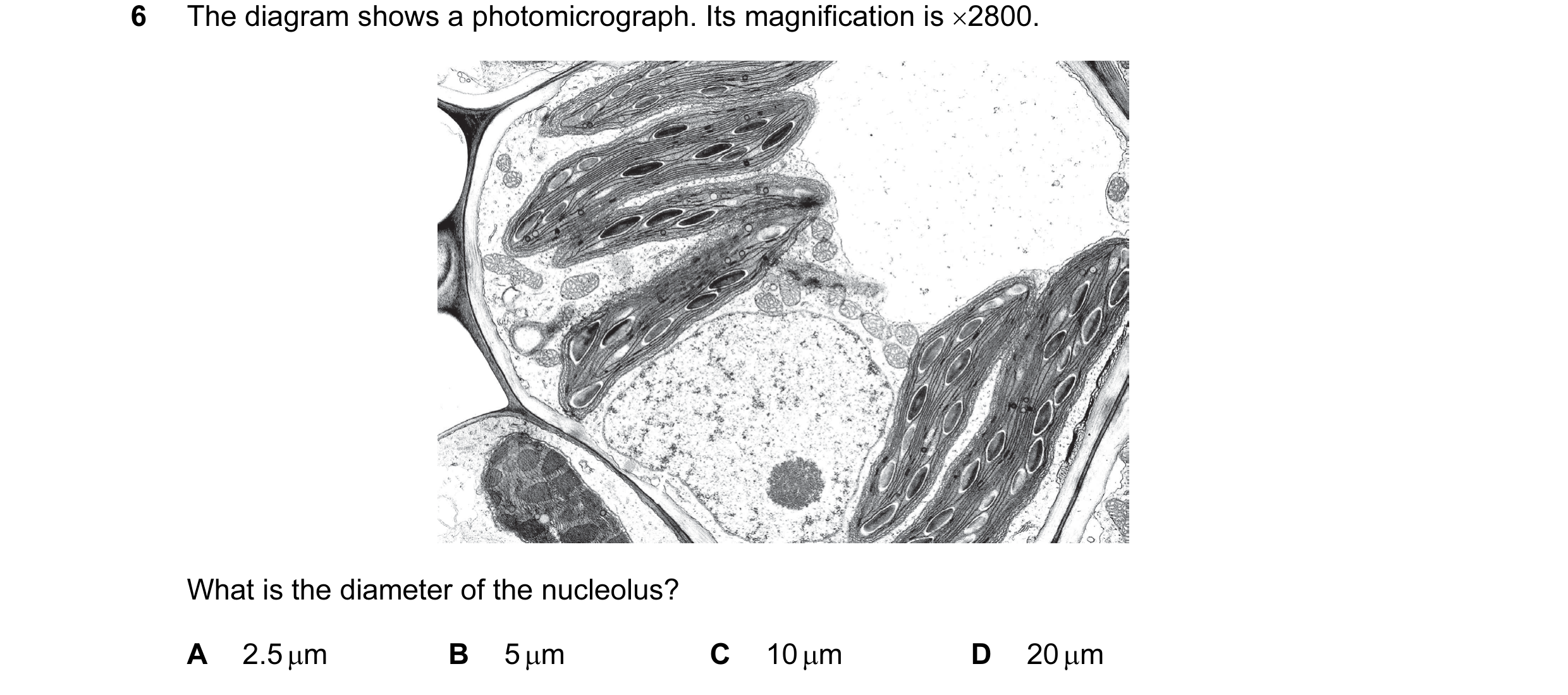 Question 11: The diagram shows a photomicrograph. Its magnification is ×2800. What is the diameter of the nucleolus? A 2.5 µm B 5 µm C 10 µm D 20 µm