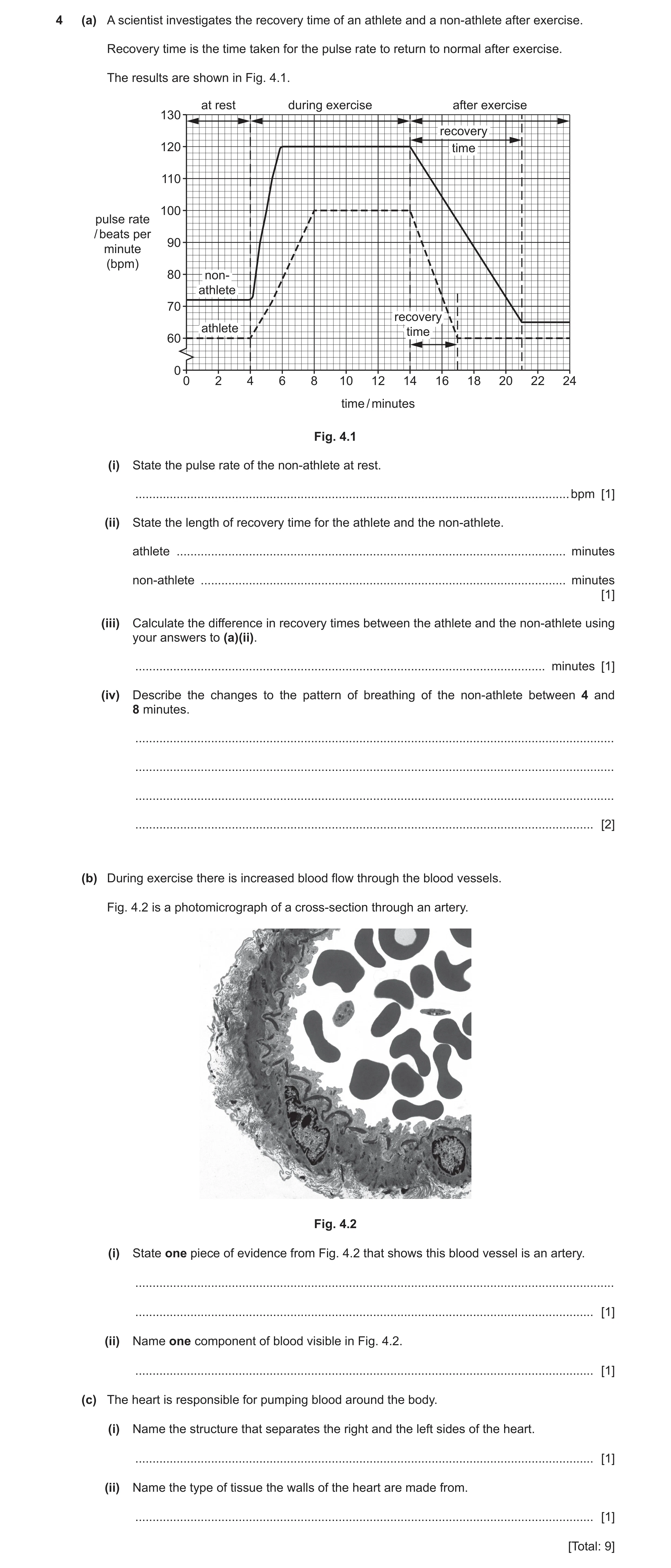 Question 7: (a) A scientist investigates the recovery time of an athlete and a non‑athlete after exercise. Recovery time is the time taken for the puls…