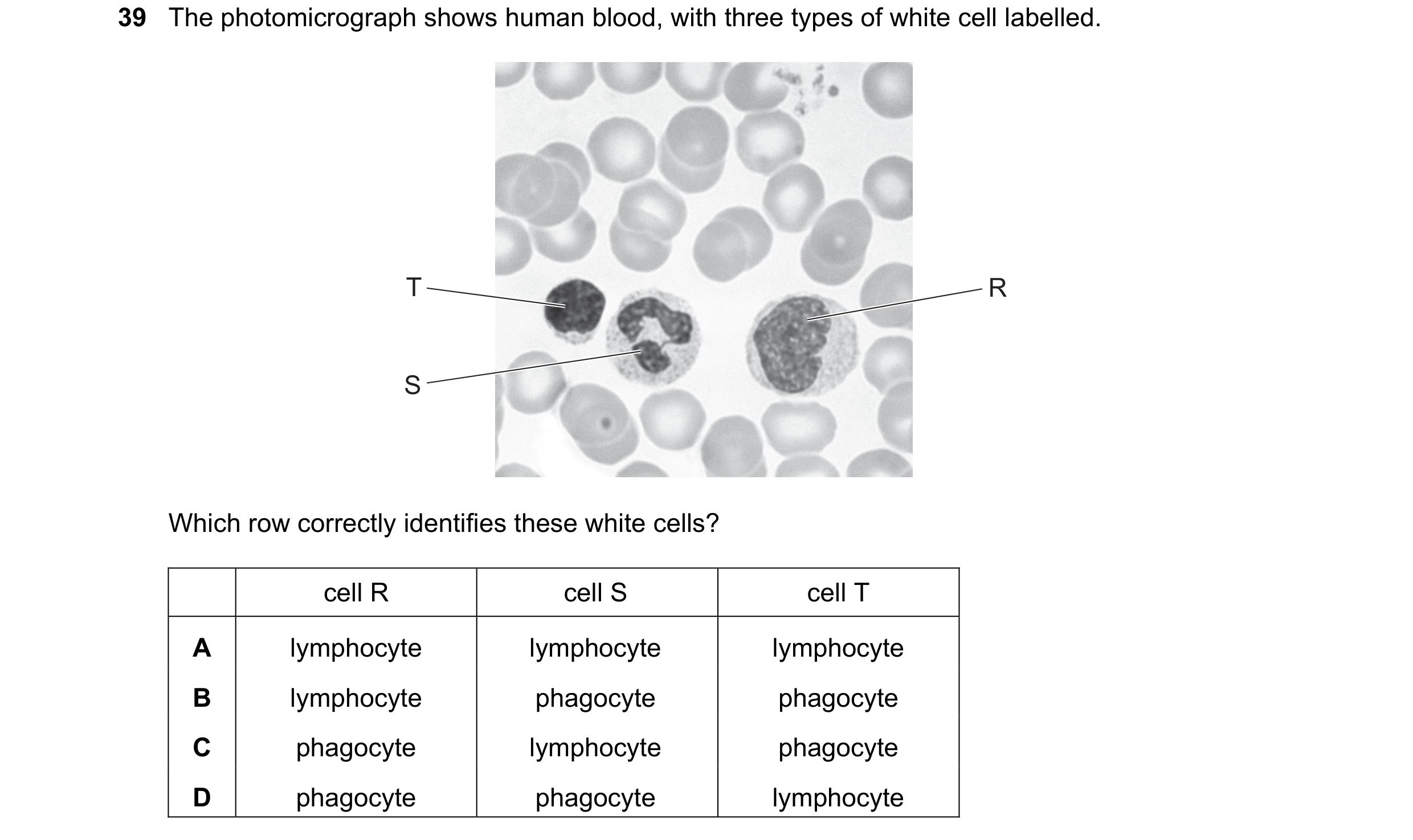 Question 71: The photomicrograph shows human blood, with three types of white cell labelled. T R S Which row correctly identifies these white cells? cel…