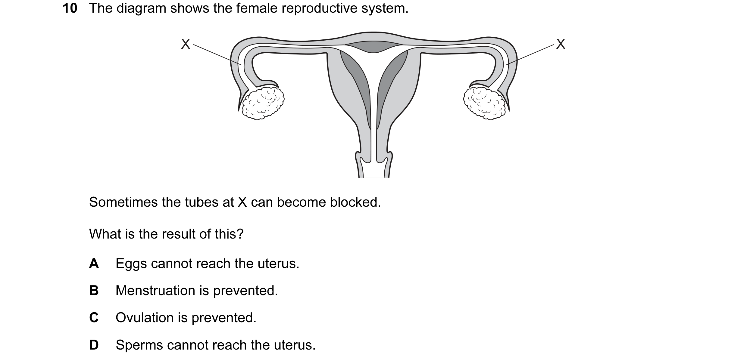 Question 37: The diagram shows the female reproductive system. X X Sometimes the tubes at X can become blocked. What is the result of this? A Eggs canno…
