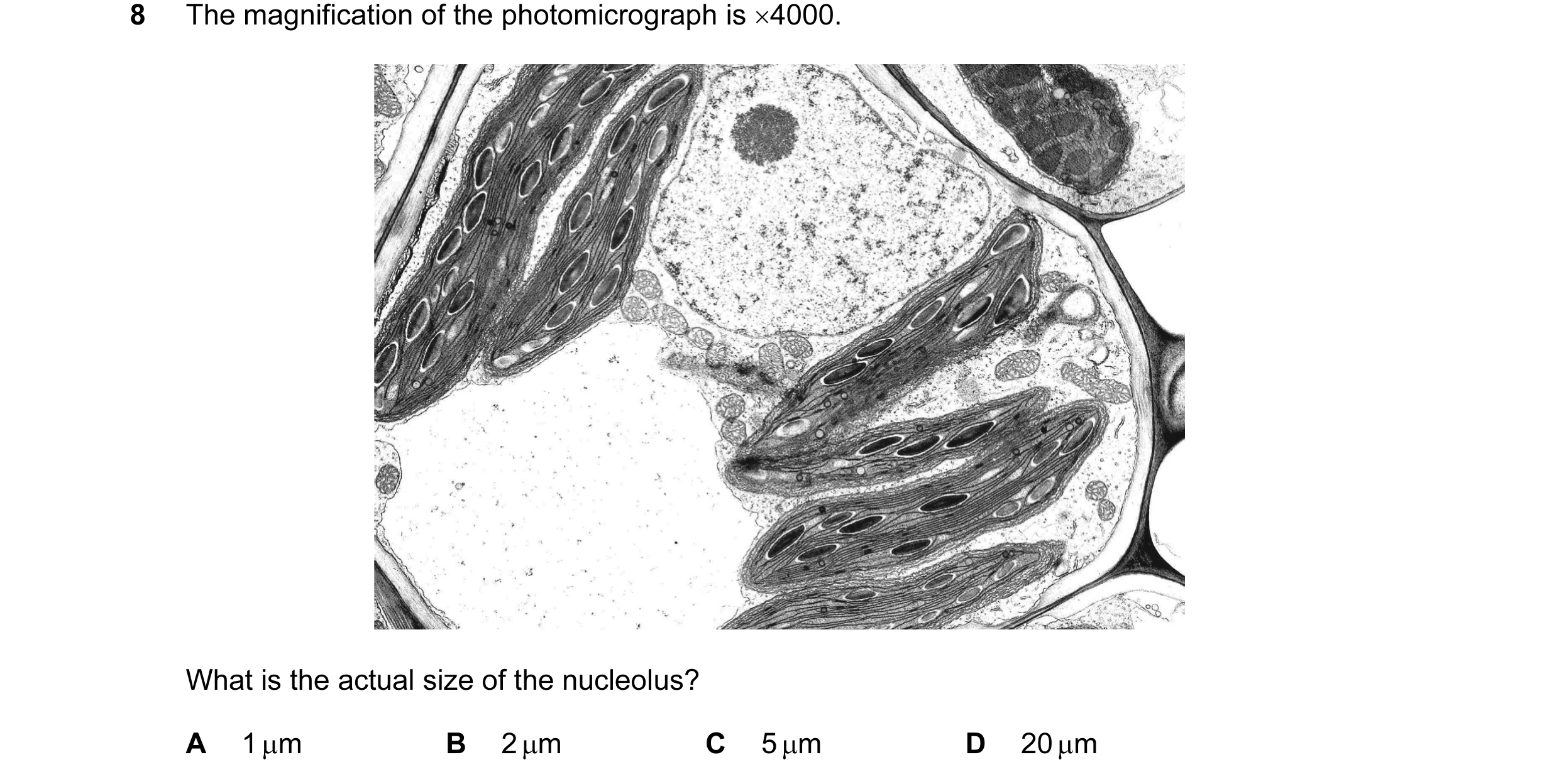 Question 52: The magnification of the photomicrograph is ×4000. What is the actual size of the nucleolus? A 1 µm B 2 µm C 5 µm D 20 µm