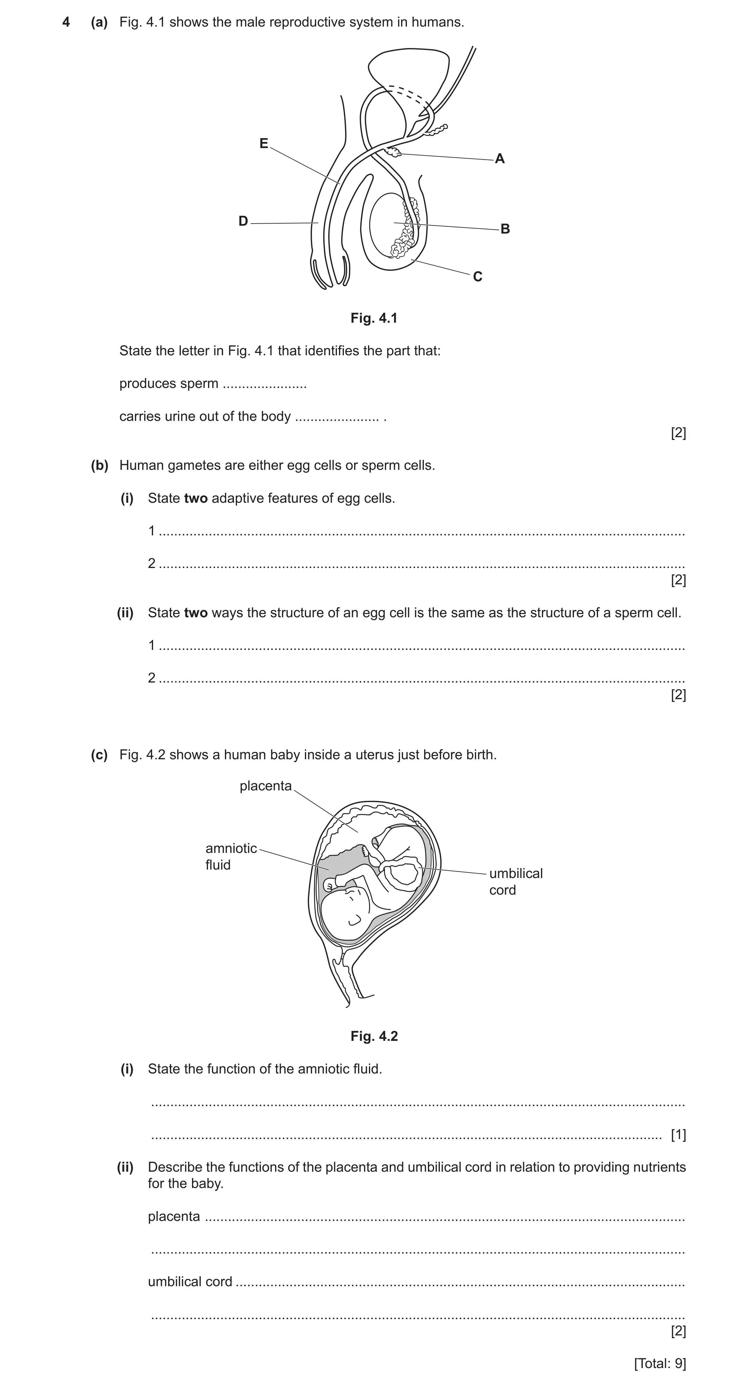 Question 17: (a) Fig. 4.1 shows the male reproductive system in humans. E A D B C Fig. 4.1 State the letter in Fig. 4.1 that identifies the part that: p…