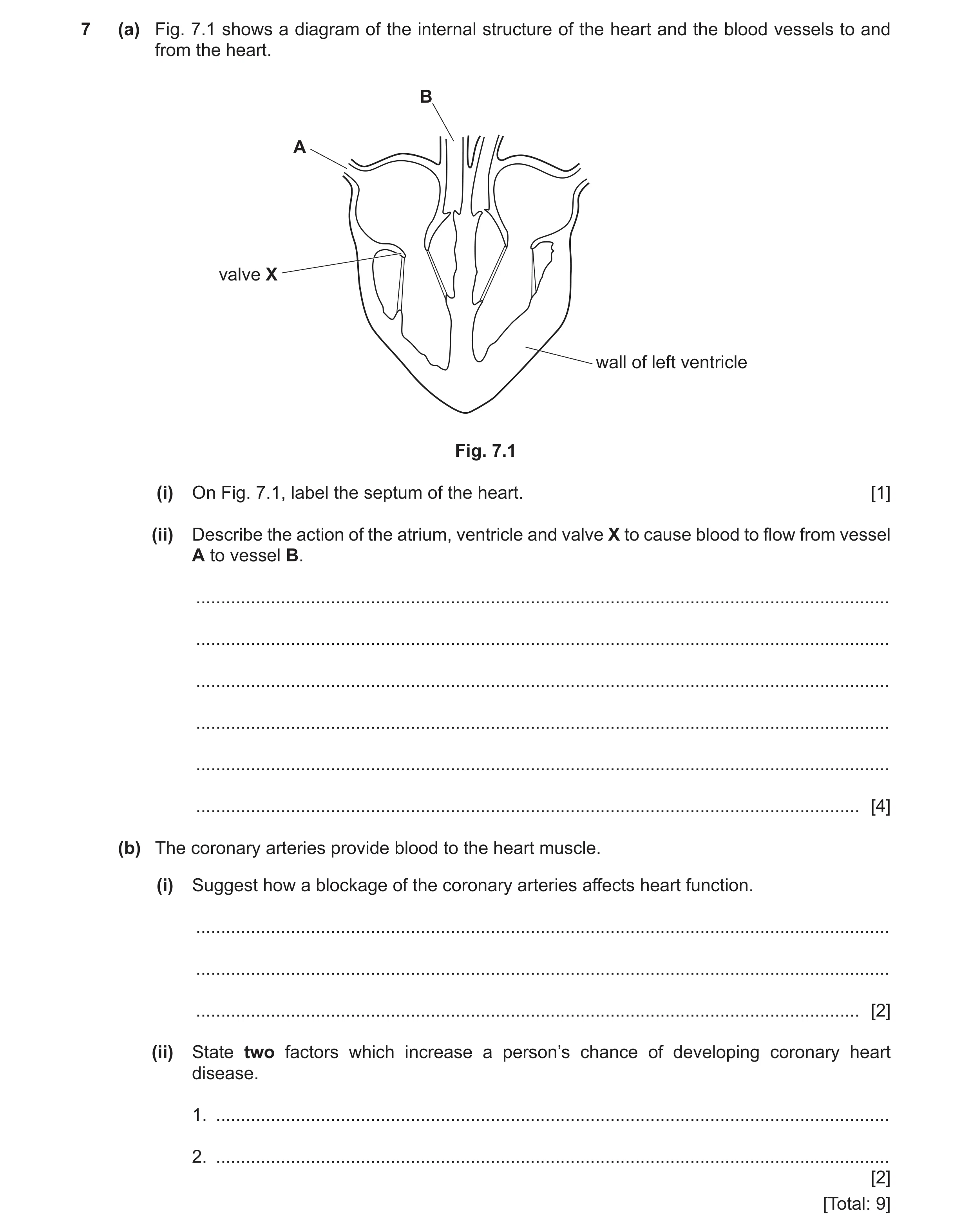Question 8: (a) Fig. 7.1 shows a diagram of the internal structure of the heart and the blood vessels to and from the heart. B A valve X wall of left v…