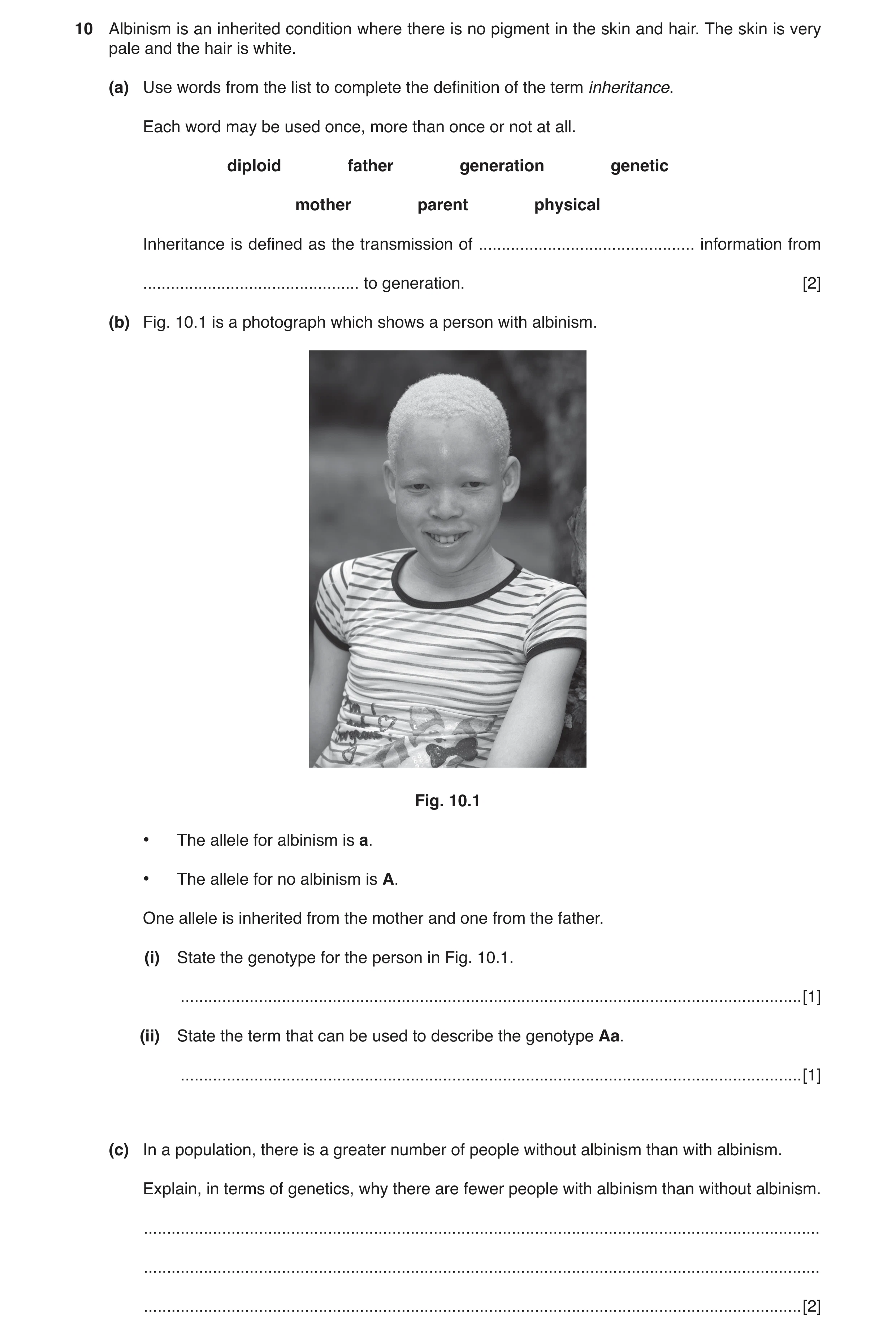 Question 4: Albinism is an inherited condition where there is no pigment in the skin and hair. The skin is very pale and the hair is white. (a) Use wor…
