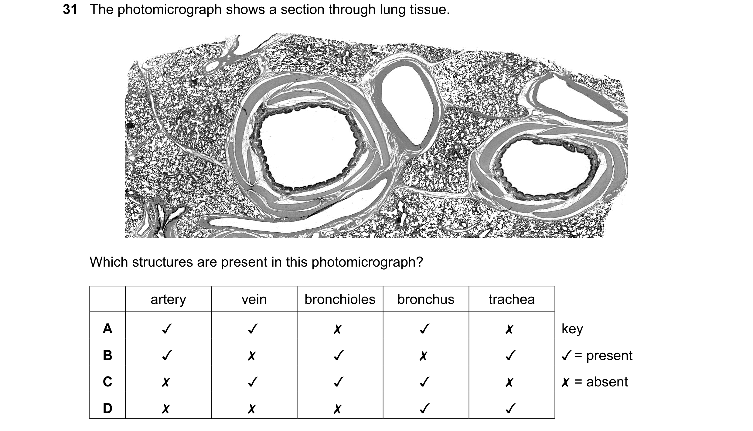 Question 128: The photomicrograph shows a section through lung tissue.
Which structures are present in this photomicrograph?
artery vein bronchioles | …