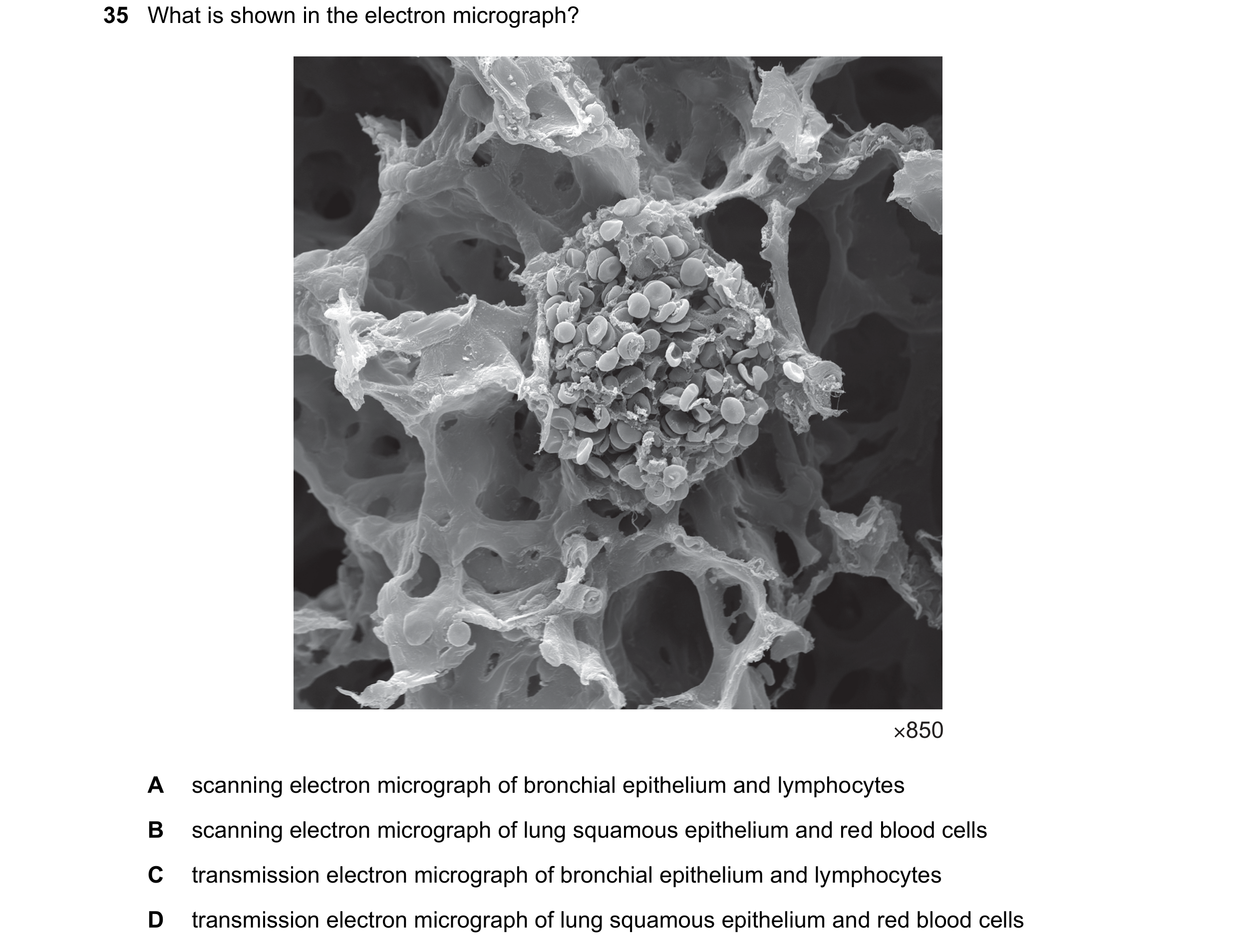 Question 234: What is shown in the electron micrograph? ×850 A scanning electron micrograph of bronchial epithelium and lymphocytes B scanning electron m…