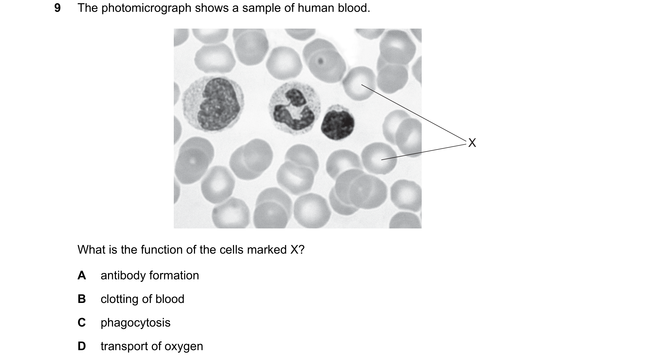 Question 3: The photomicrograph shows a sample of human blood. X What is the function of the cells marked X? A antibody formation B clotting of blood C…