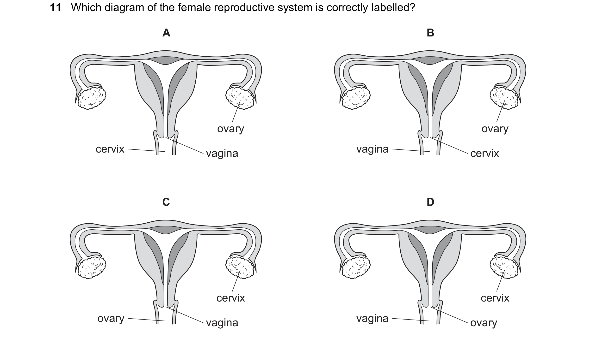 Question 79: Which diagram of the female reproductive system is correctly labelled? A B ovary ovary cervix vagina vagina cervix C D cervix cervix ovary …