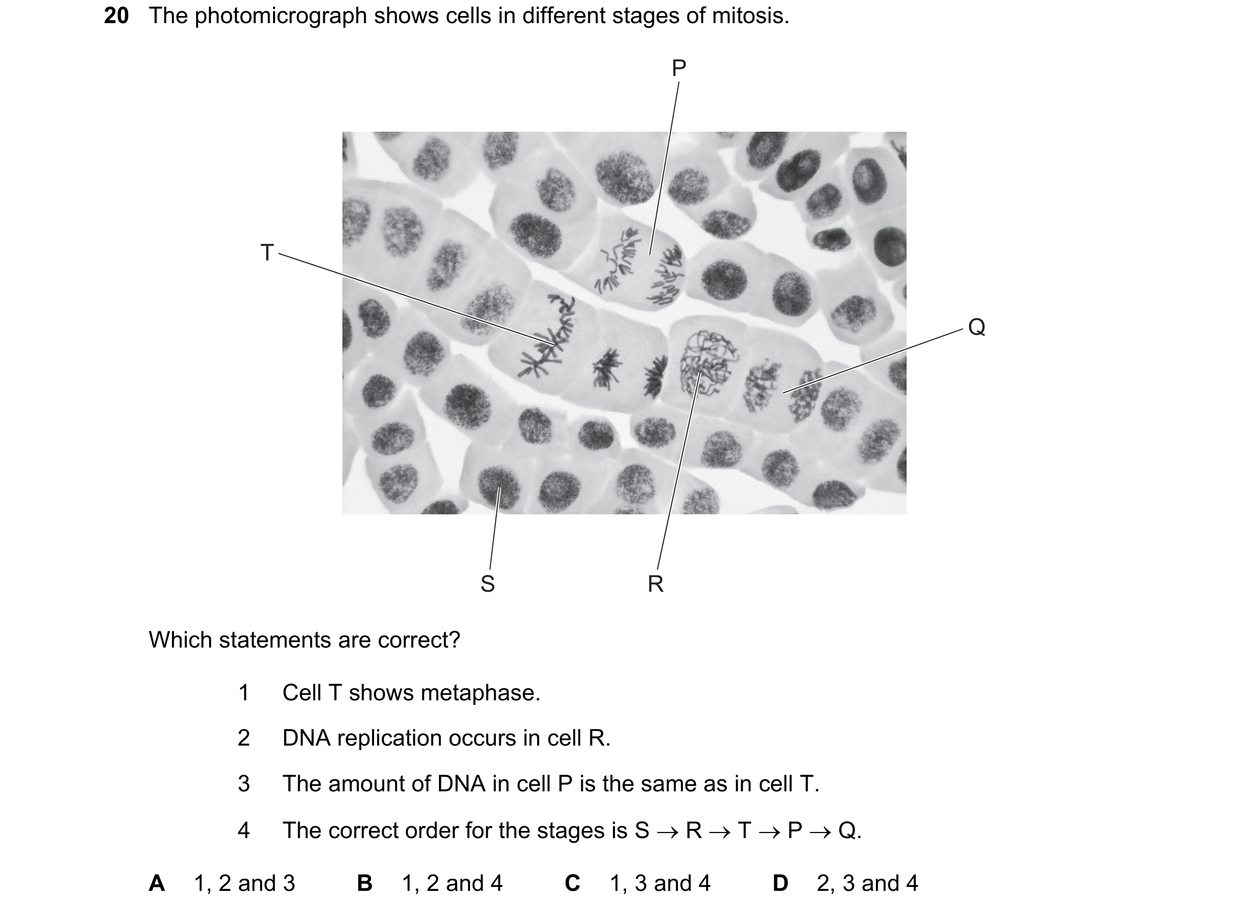 Question 67: The photomicrograph shows cells in different stages of mitosis. P T Q S R Which statements are correct? 1 Cell T shows metaphase. 2 DNA rep…