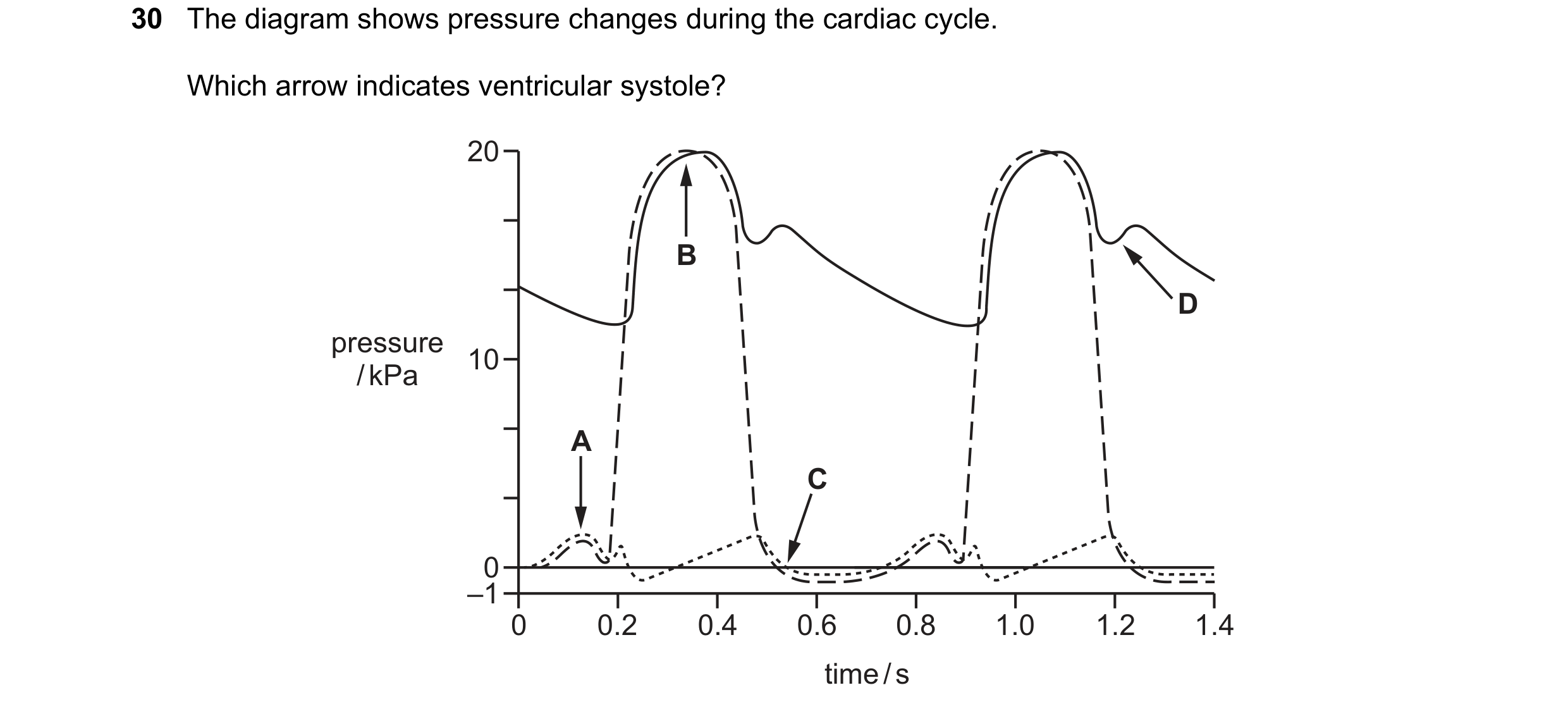 Question 80: The diagram shows pressure changes during the cardiac cycle. Which arrow indicates ventricular systole? 20 B D pressure 10 / kPa A C 0 –1 0…