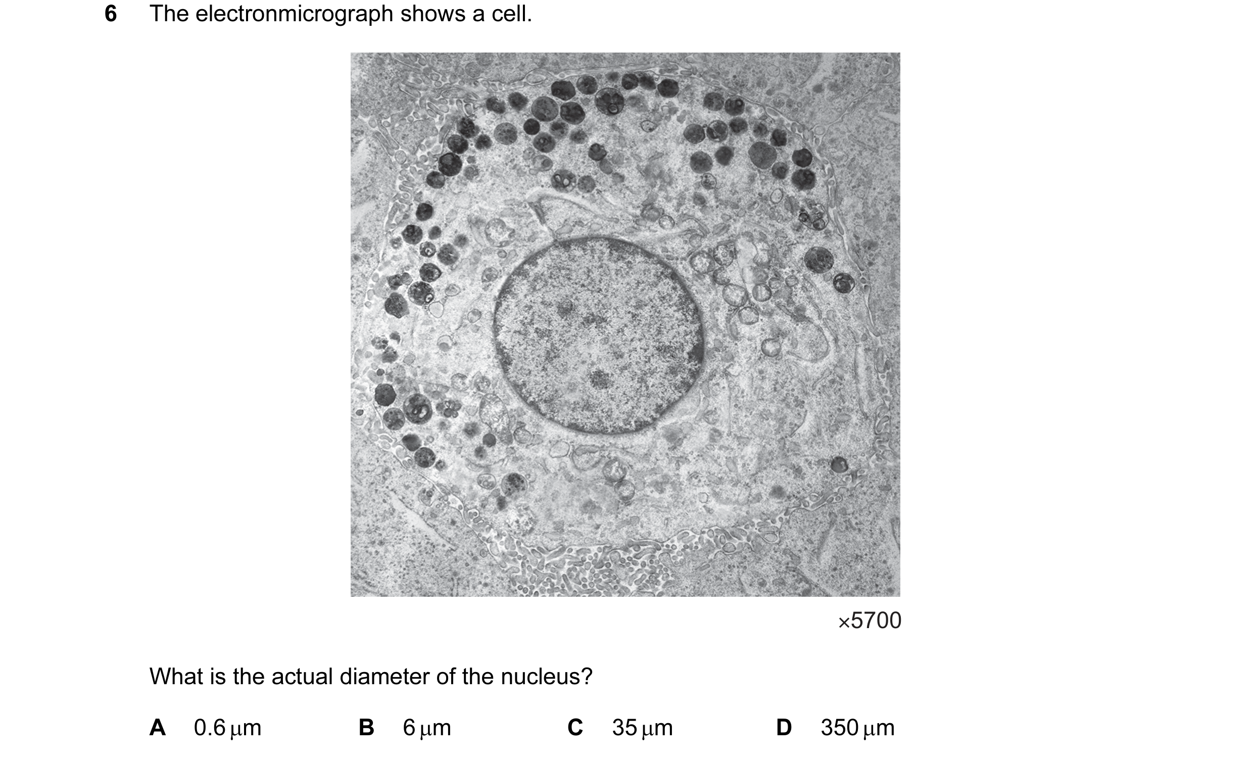 Question 84: The electronmicrograph shows a cell. ×5700 What is the actual diameter of the nucleus? A 0.6 µm B 6 µm C 35 µm D 350 µm