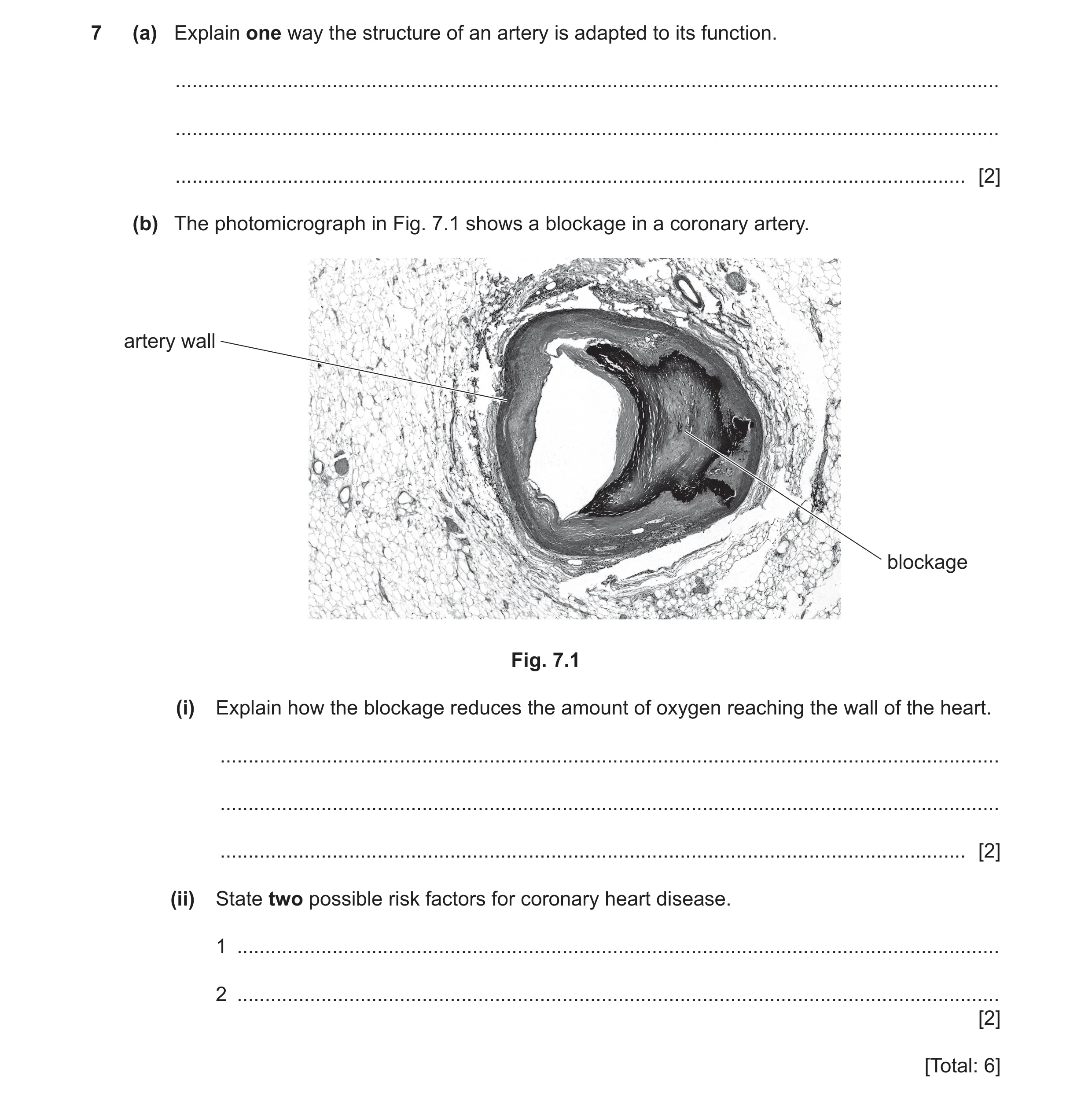 Question 8: (a) Explain one way the structure of an artery is adapted to its function. ................................................................…