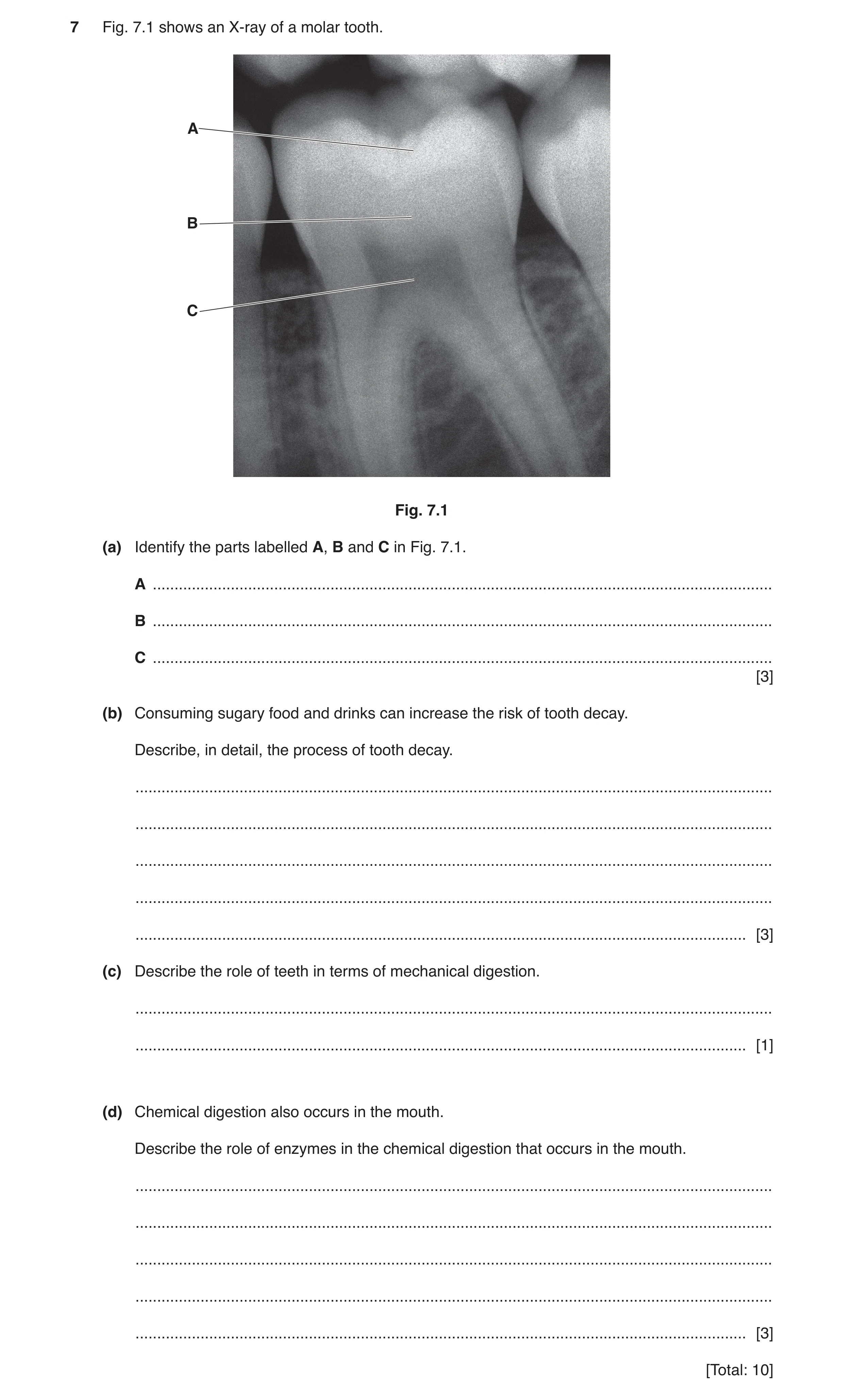 Question 5: Fig. 7.1 shows an X-ray of a molar tooth. A B C Fig. 7.1 (a) Identify the parts labelled A, B and C in Fig. 7.1. A ........................…