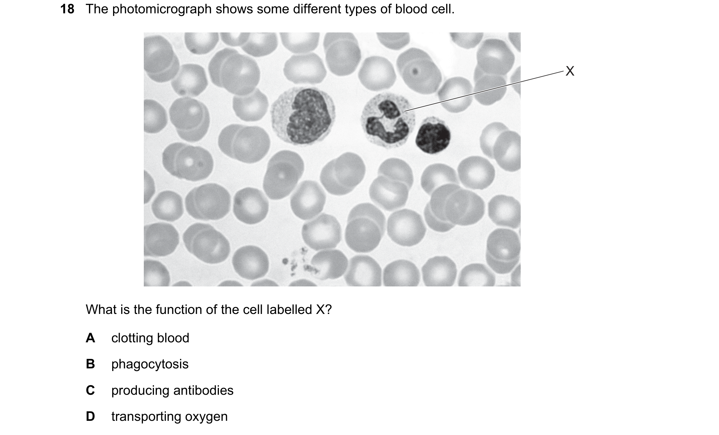 Question 27: The photomicrograph shows some different types of blood cell. X What is the function of the cell labelled X? A clotting blood B phagocytosi…