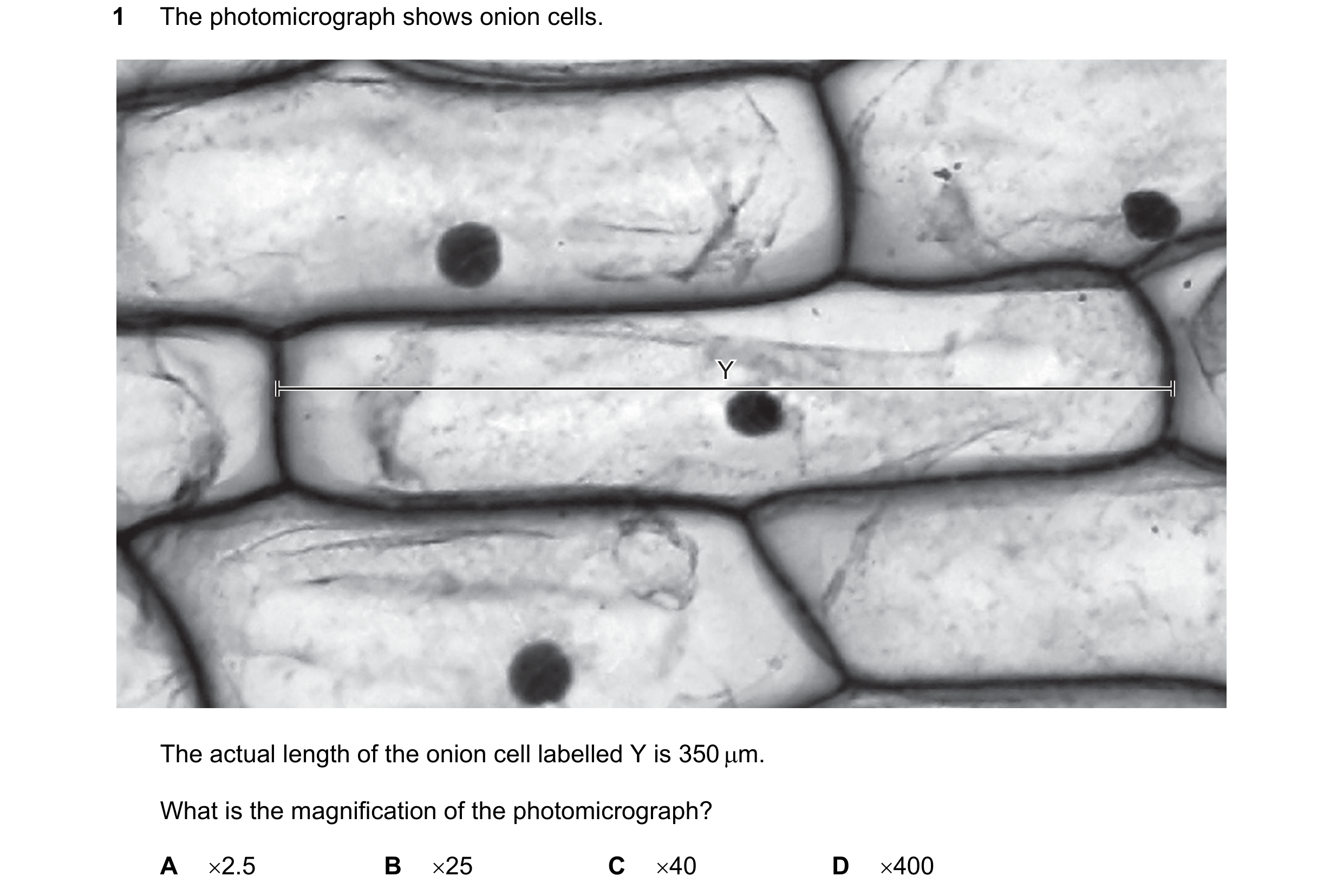 Question 143: The photomicrograph shows onion cells. Y The actual length of the onion cell labelled Y is 350 m. What is the magnification of the photomi…