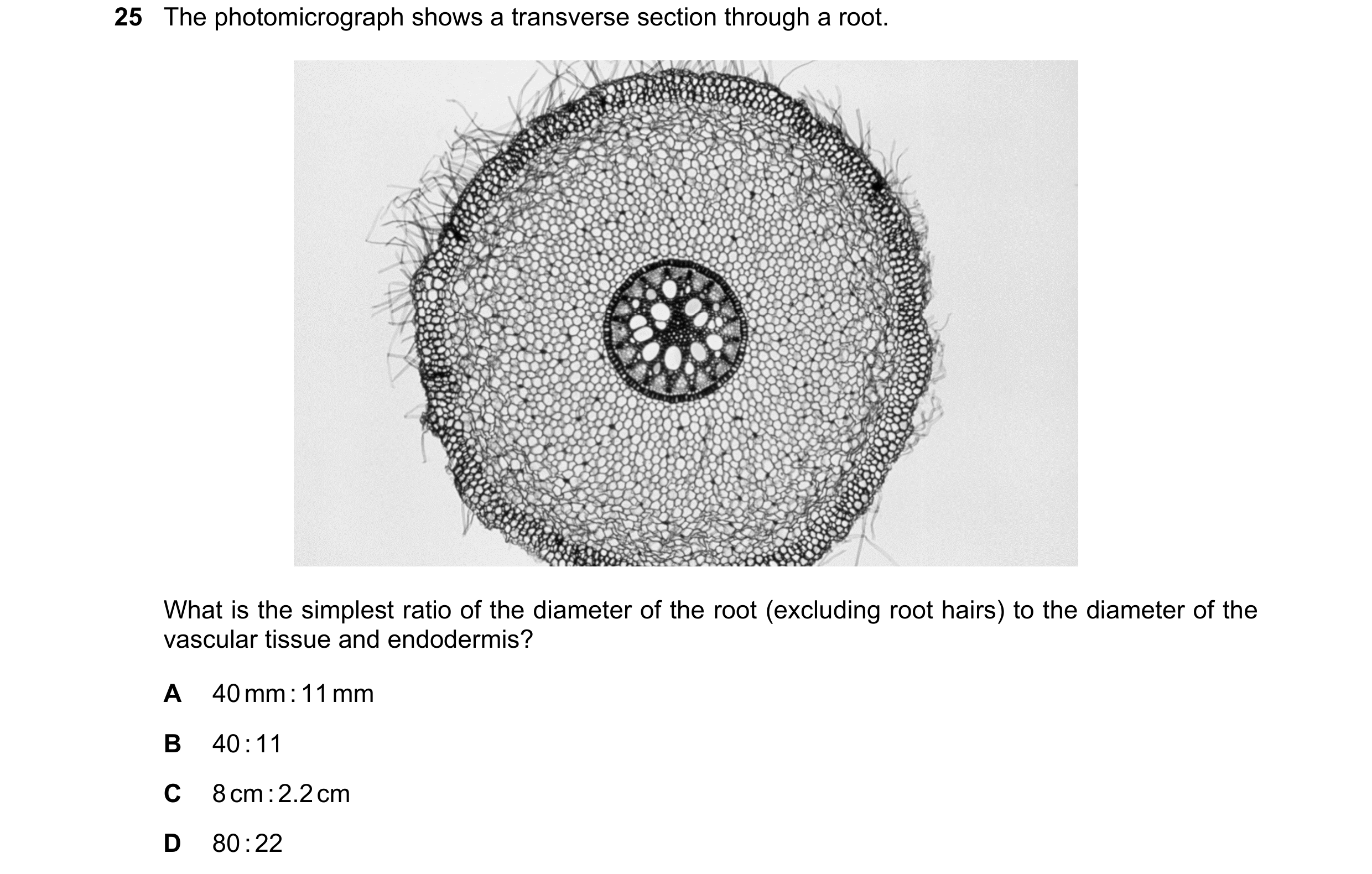 Question 57: The photomicrograph shows a transverse section through a root. What is the simplest ratio of the diameter of the root (excluding root hairs…