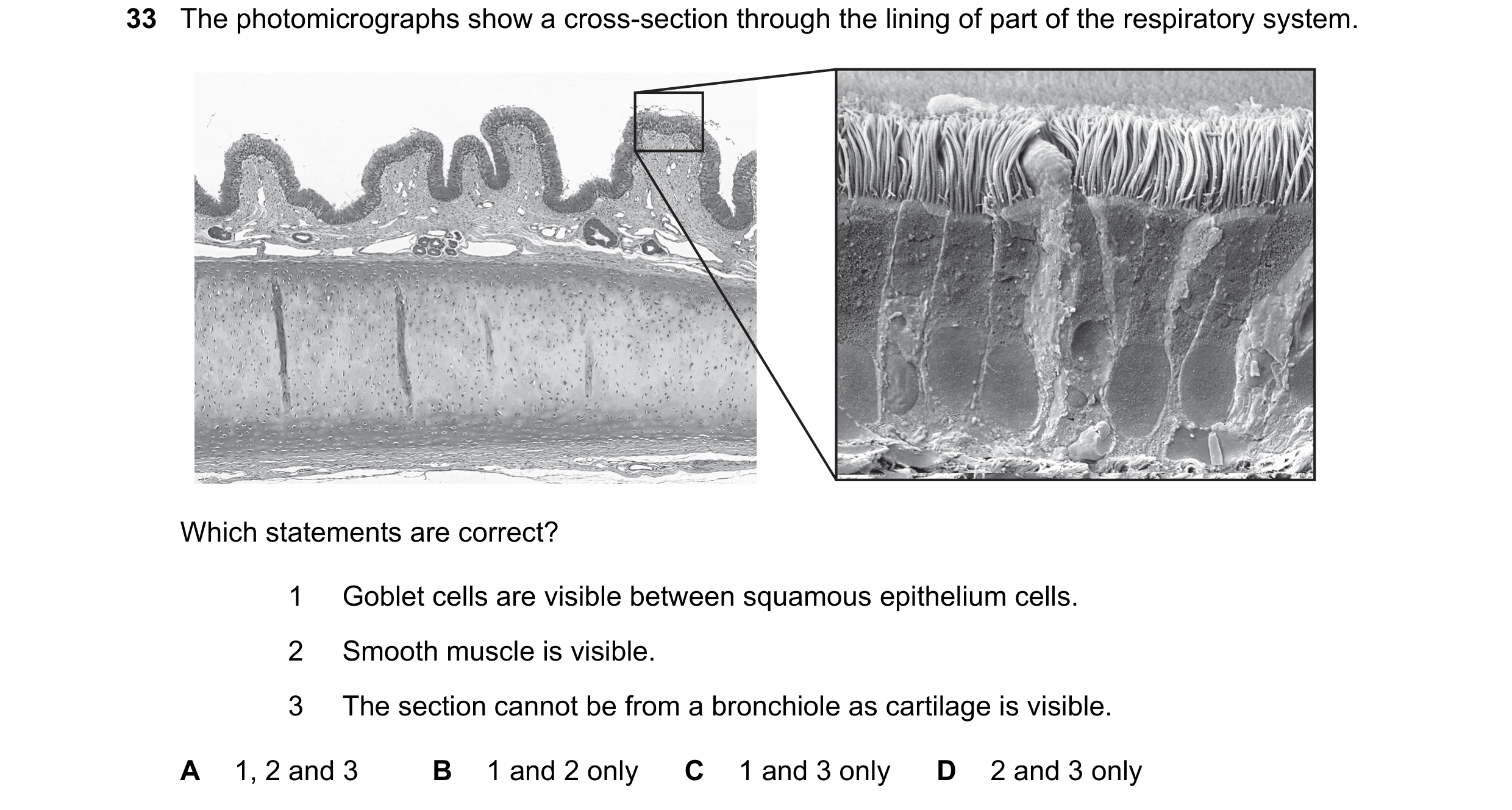 Question 151: The photomicrographs show a cross-section through the lining of part of the respiratory system. Which statements are correct? 1 Goblet cell…