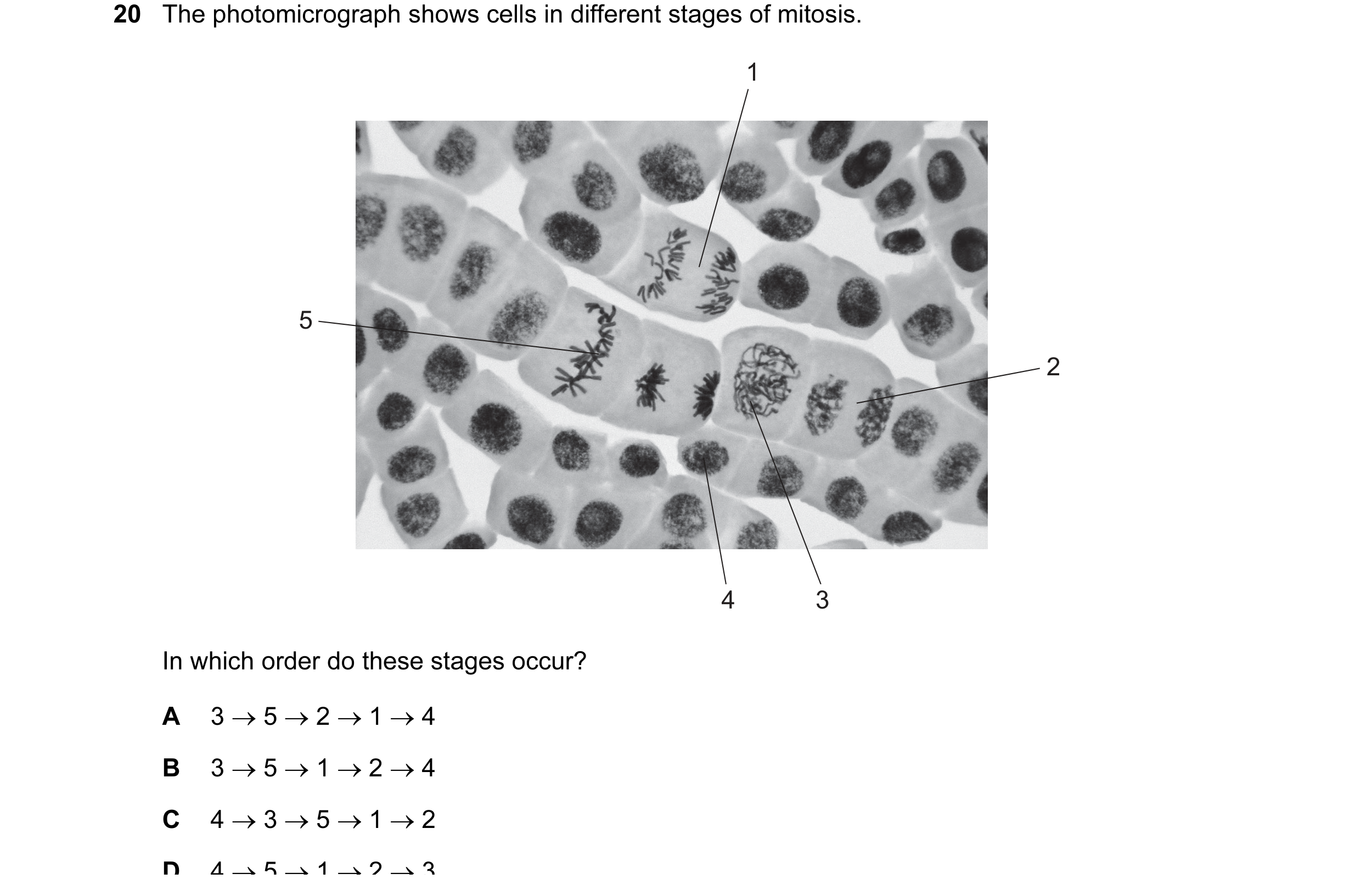 Question 37: The photomicrograph shows cells in different stages of mitosis. 1 5 2 4 3 In which order do these stages occur? A 3 → 5 → 2 → 1 → 4 B 3 → 5…