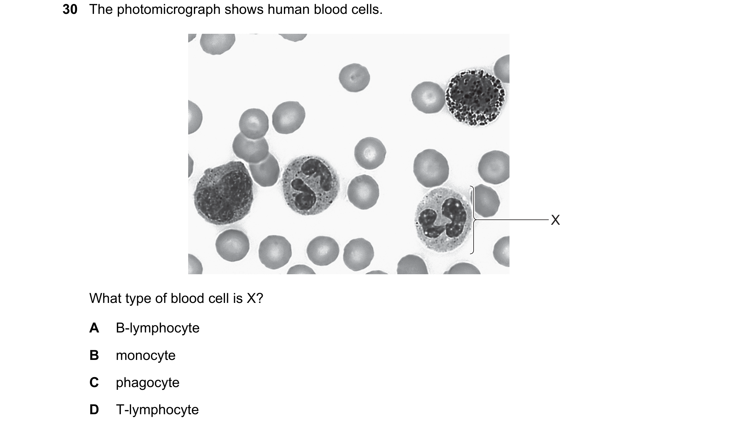Question 109: The photomicrograph shows human blood cells. X What type of blood cell is X? A B-lymphocyte B monocyte C phagocyte D T-lymphocyte