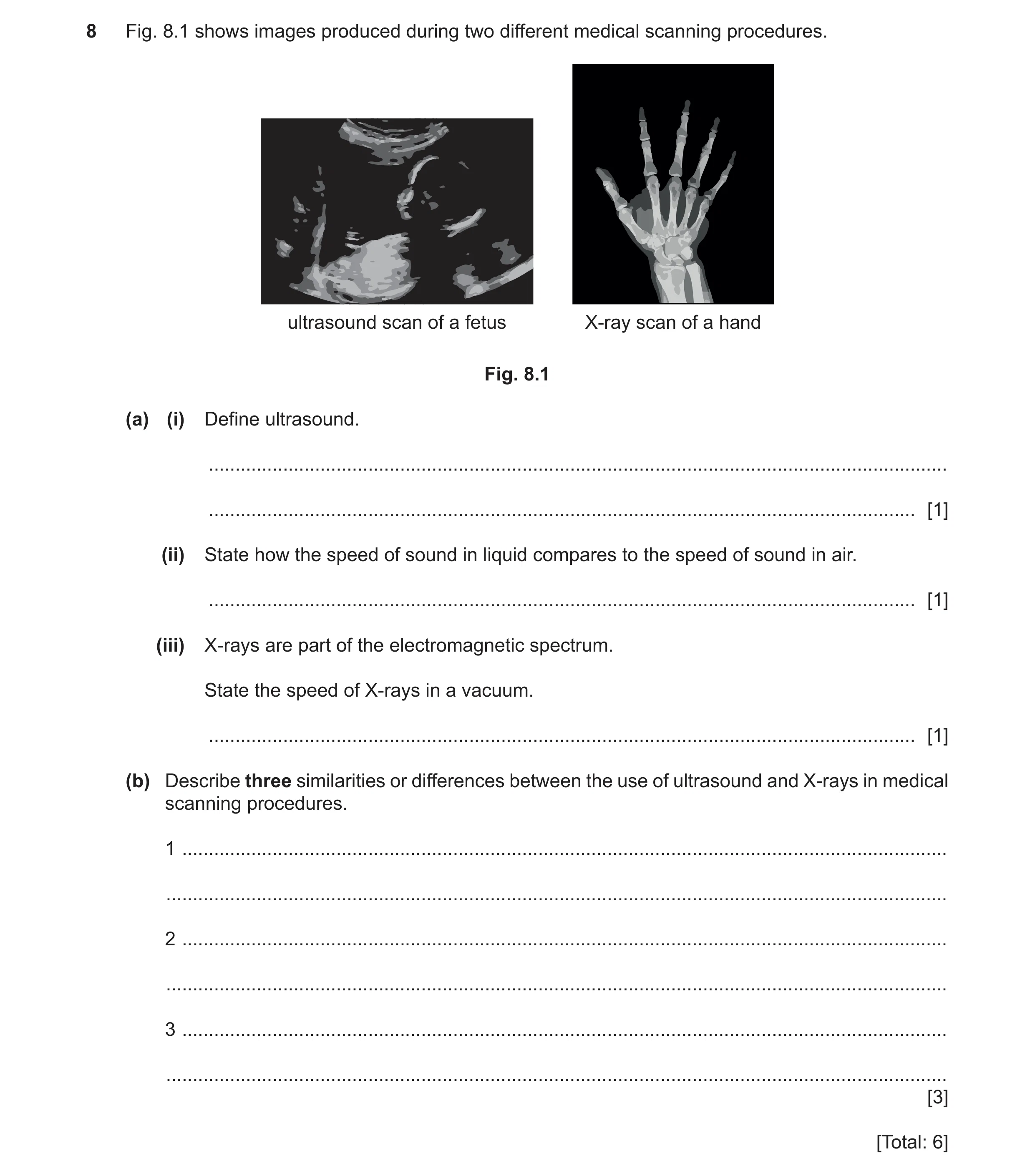 Question 25: Fig. 8.1 shows images produced during two different medical scanning procedures. ultrasound scan of a fetus X-ray scan of a hand Fig. 8.1 (…