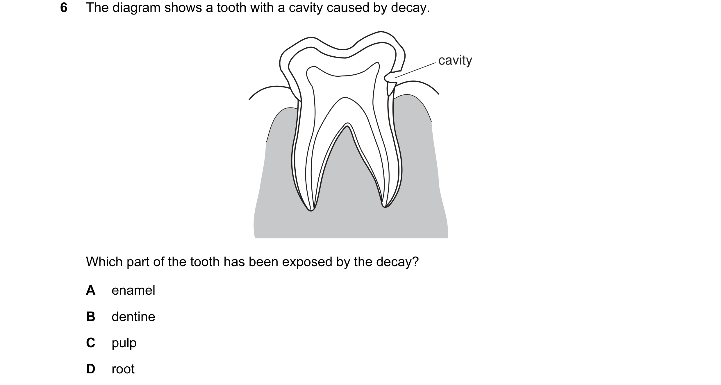 Question 13: The diagram shows a tooth with a cavity caused by decay. cavity Which part of the tooth has been exposed by the decay? A enamel B dentine C…