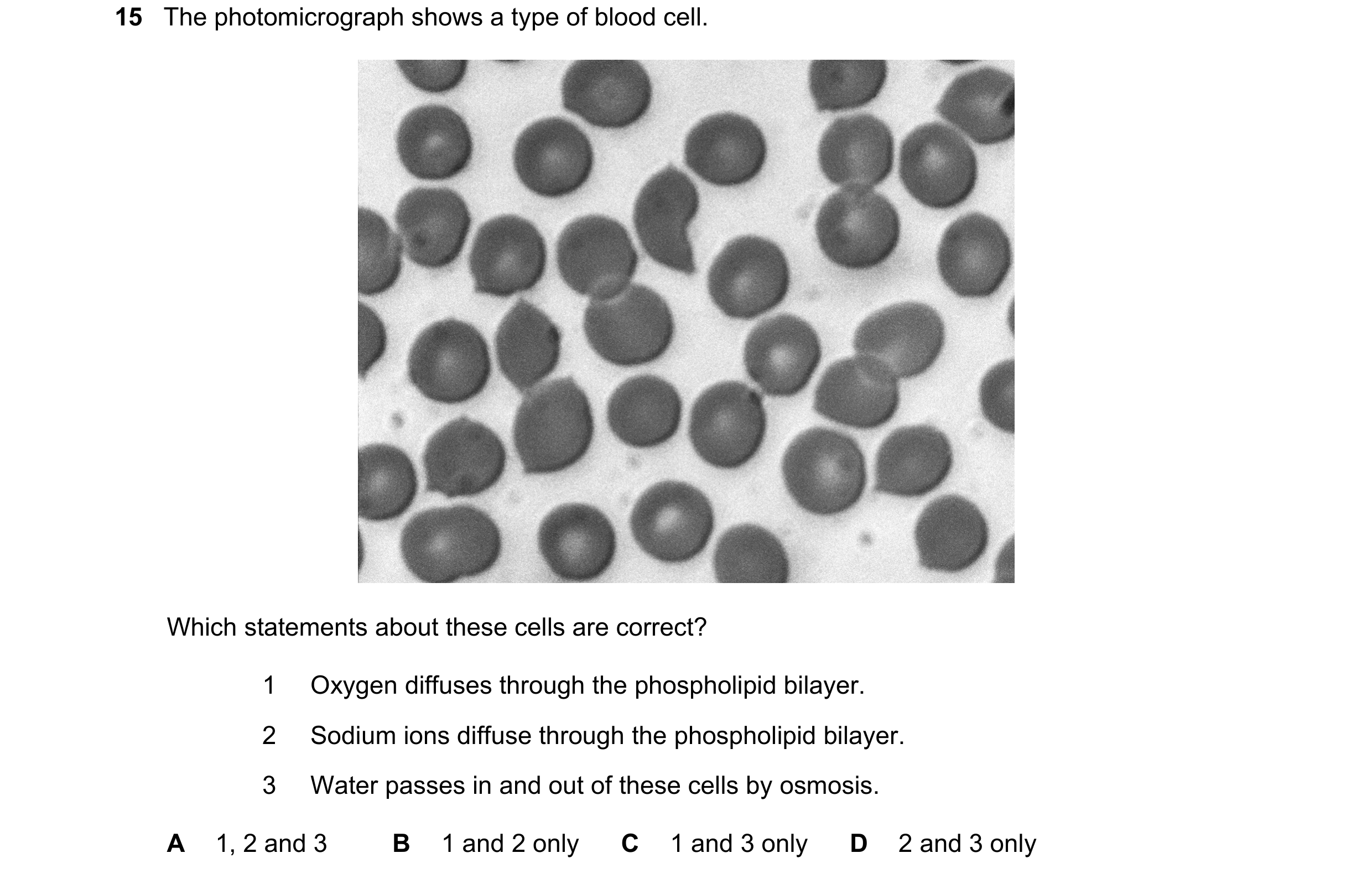 Question 242: The photomicrograph shows a type of blood cell. Which statements about these cells are correct? 1 Oxygen diffuses through the phospholipid …