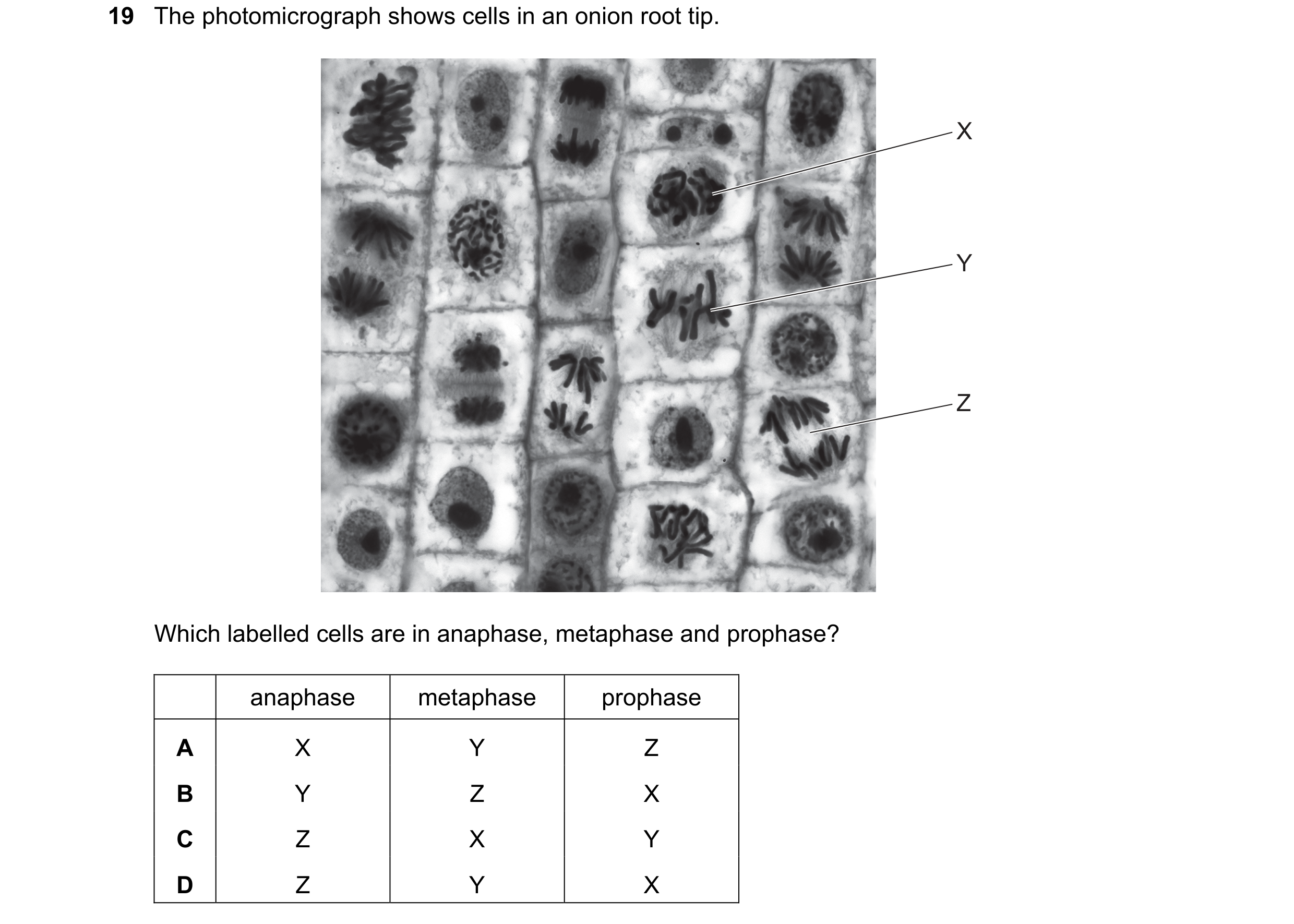 Question 125: The photomicrograph shows cells in an onion root tip. X Y Z Which labelled cells are in anaphase, metaphase and prophase? anaphase metaphas…