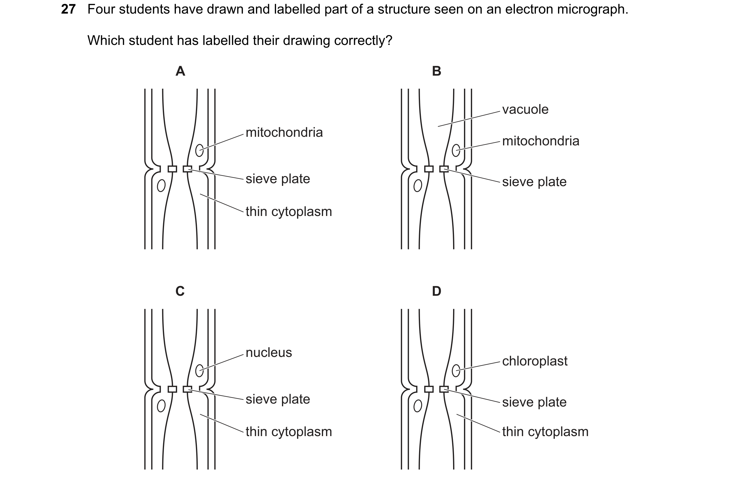 Question 112: Four students have drawn and labelled part of a structure seen on an electron micrograph. Which student has labelled their drawing correctl…