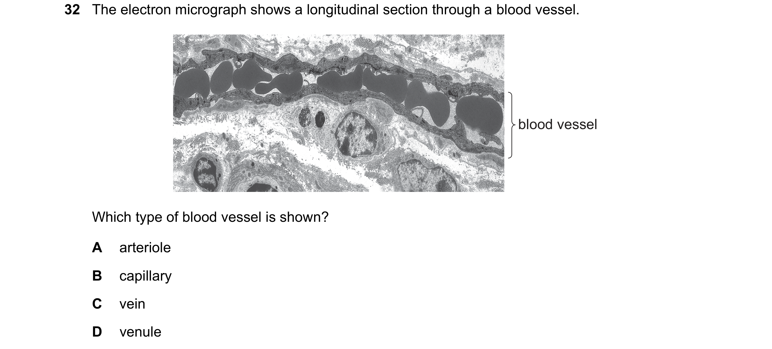 Question 152: The electron micrograph shows a longitudinal section through a blood vessel. blood vessel Which type of blood vessel is shown? A arteriole …