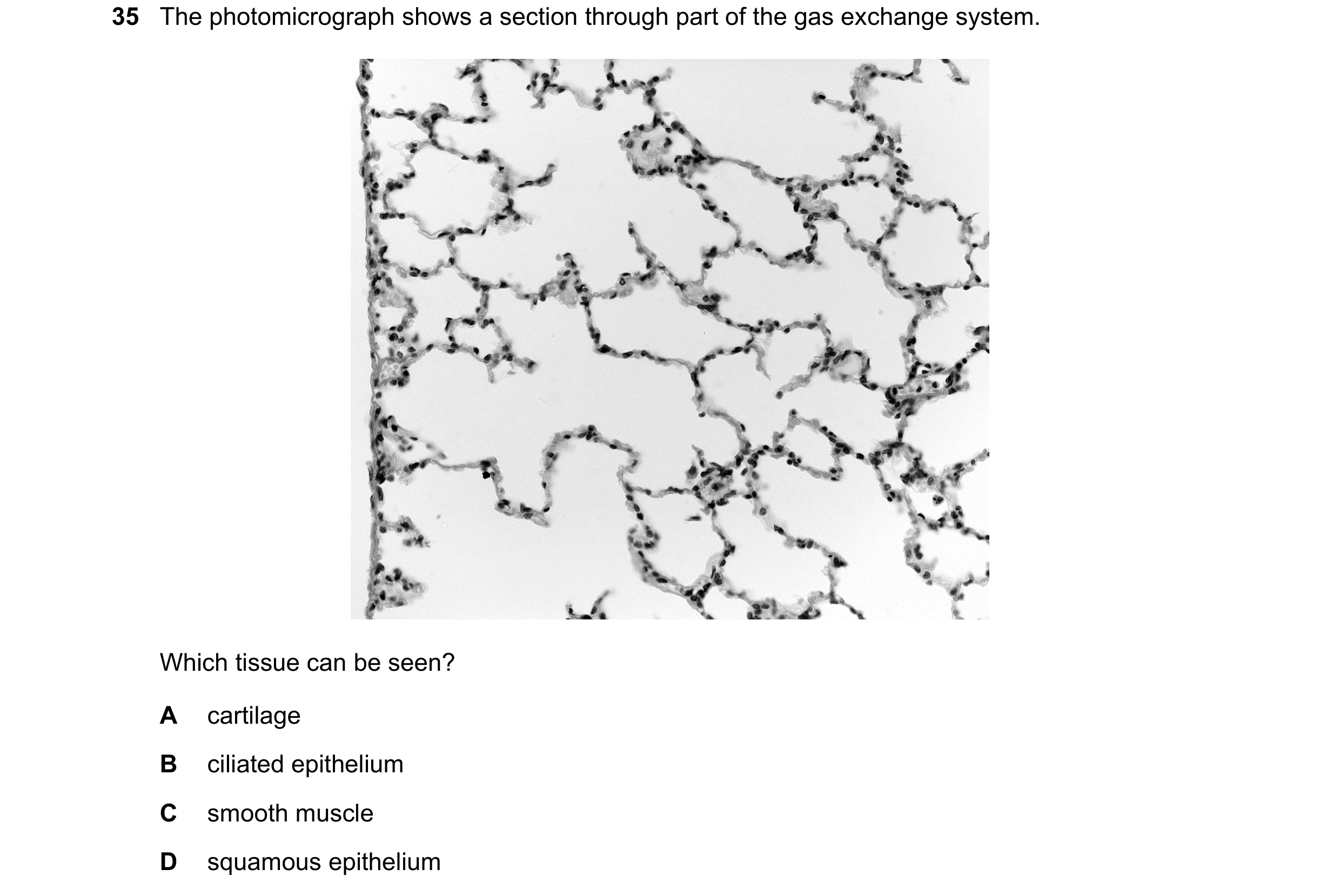 Question 259: The photomicrograph shows a section through part of the gas exchange system. Which tissue can be seen? A cartilage B ciliated epithelium C …