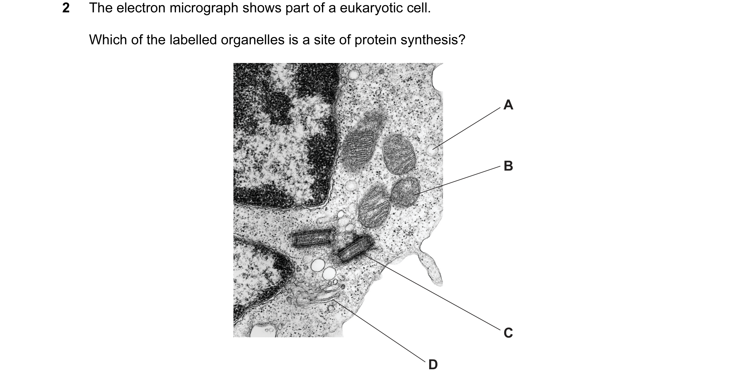 Question 78: The electron micrograph shows part of a eukaryotic cell. Which of the labelled organelles is a site of protein synthesis? A B C D