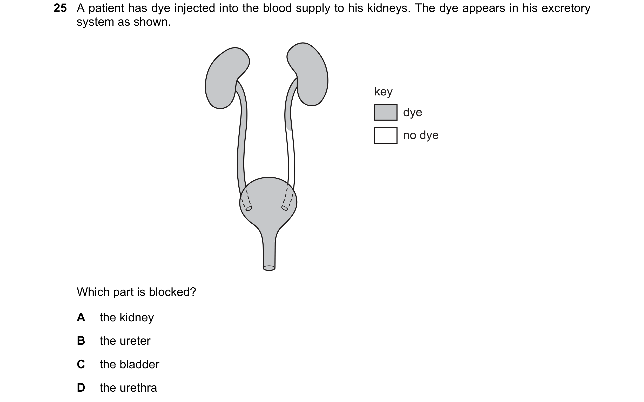 Question 5: A patient has dye injected into the blood supply to his kidneys. The dye appears in his excretory system as shown. key dye no dye Which par…