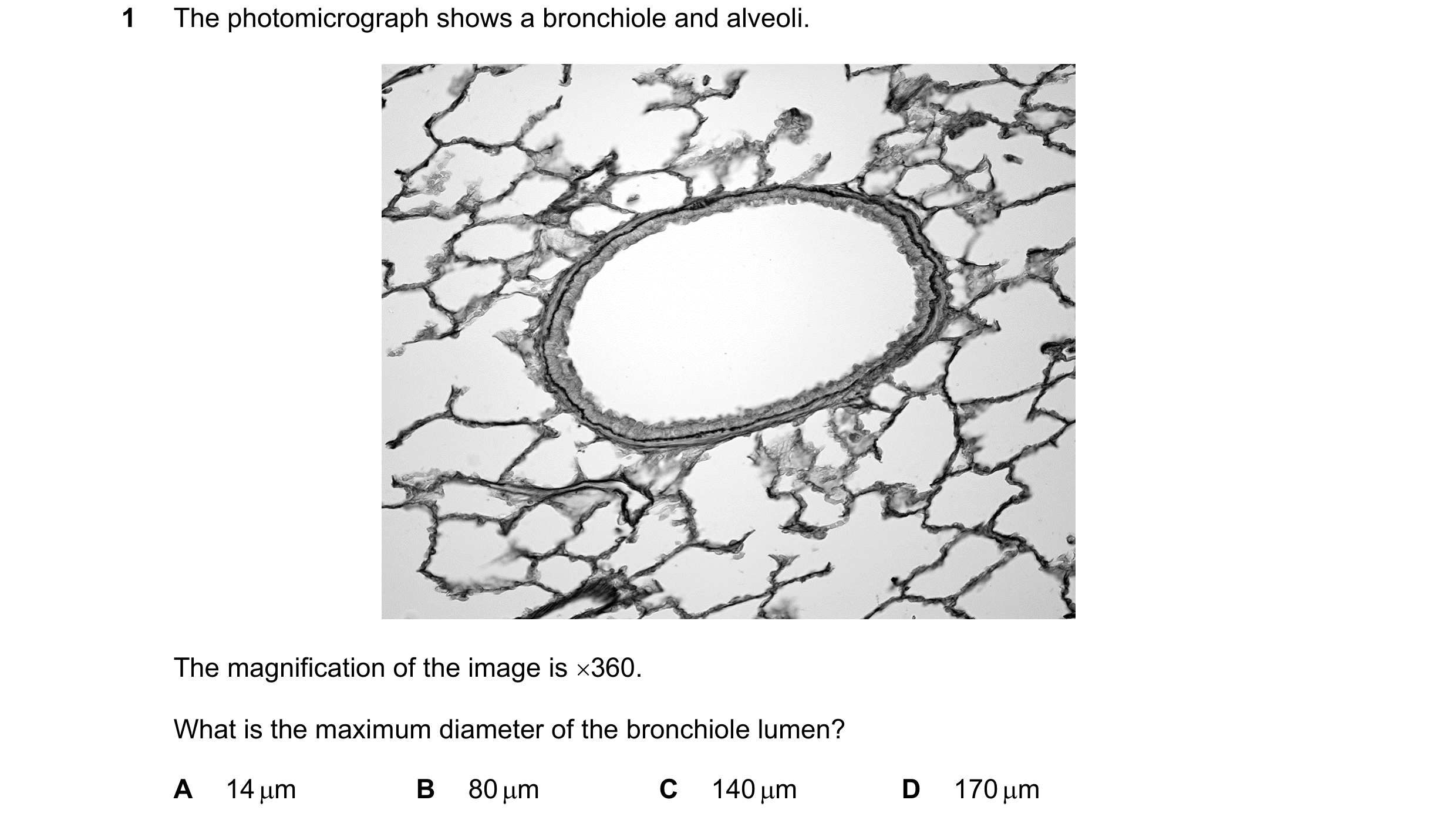 Question 160: The photomicrograph shows a bronchiole and alveoli. The magnification of the image is 360. What is the maximum diameter of the bronchiole …