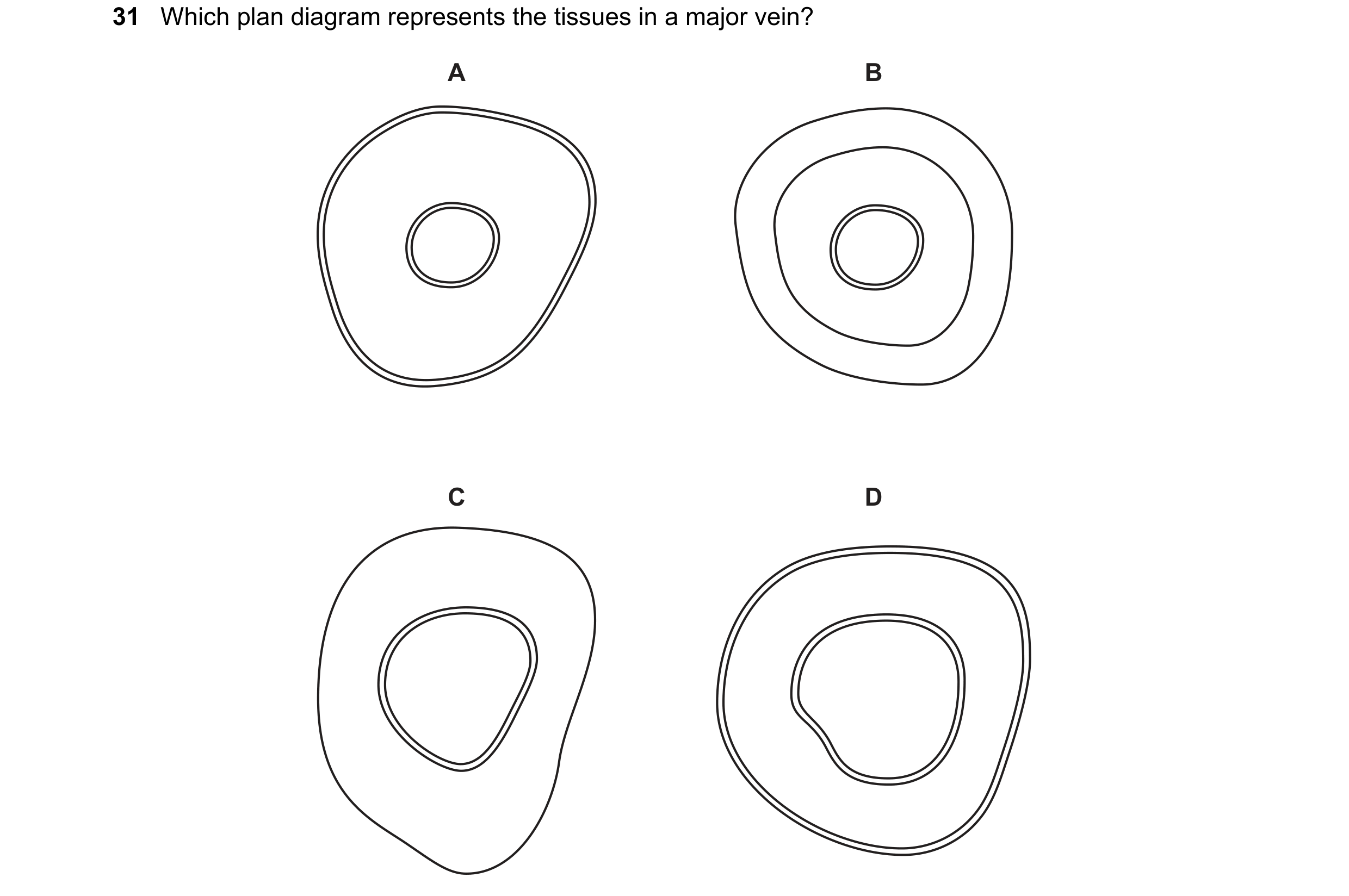 Question 123: Which plan diagram represents the tissues in a major vein? A B C D