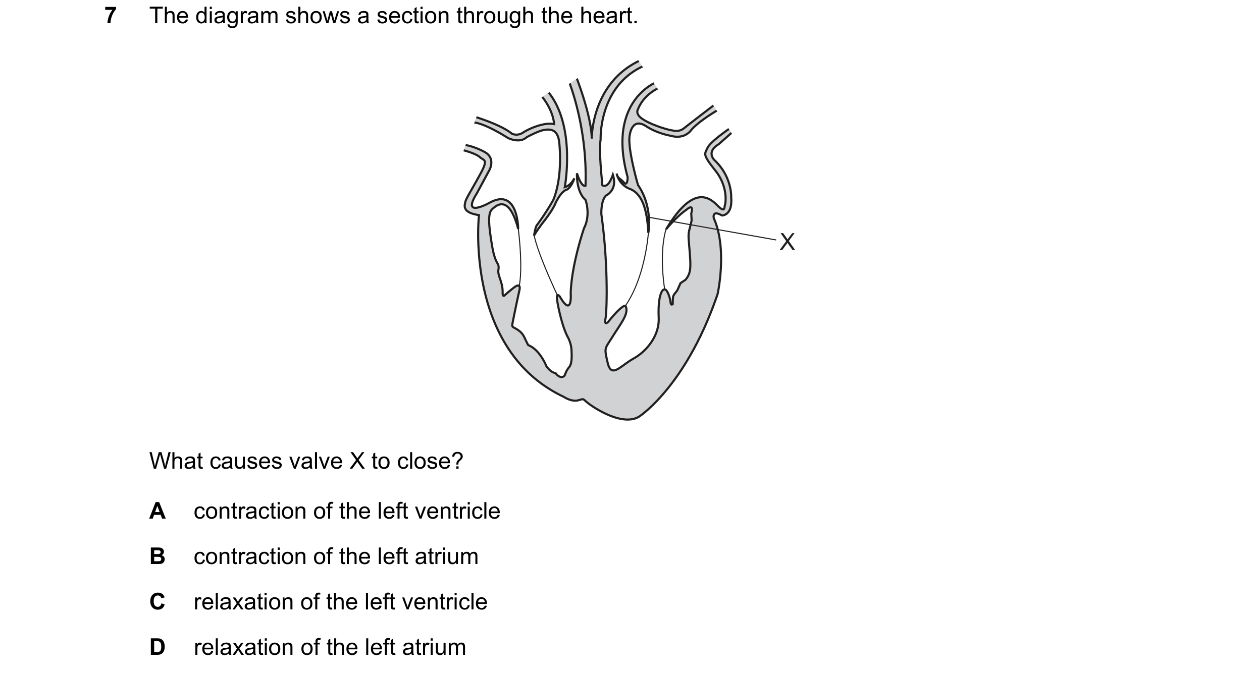 Question 22: The diagram shows a section through the heart. X What causes valve X to close? A contraction of the left ventricle B contraction of the lef…