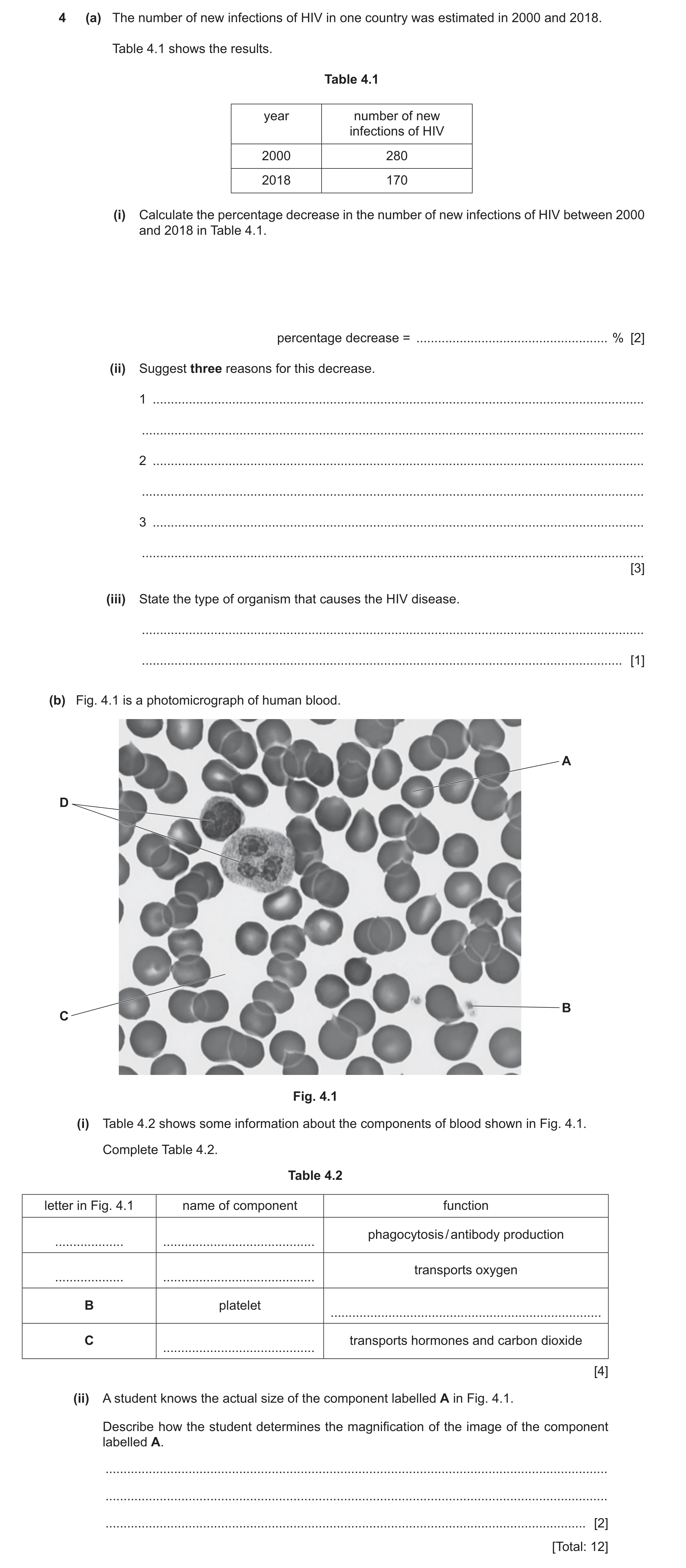 Question 17: (a) The number of new infections of HIV in one country was estimated in 2000 and 2018. Table 4.1 shows the results. Table 4.1 year number o…
