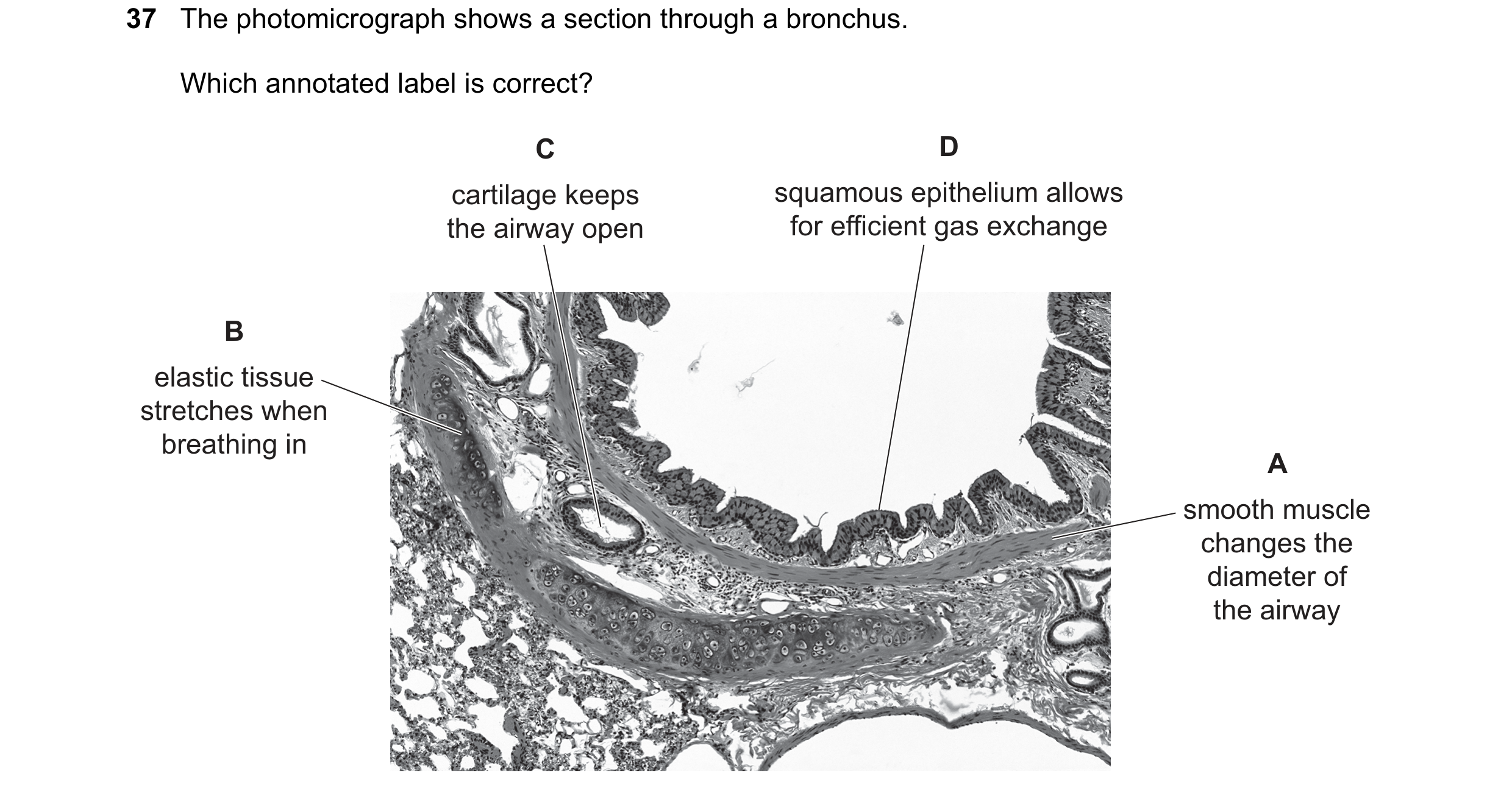 Question 221: The photomicrograph shows a section through a bronchus. Which annotated label is correct? C D cartilage keeps squamous epithelium allows th…
