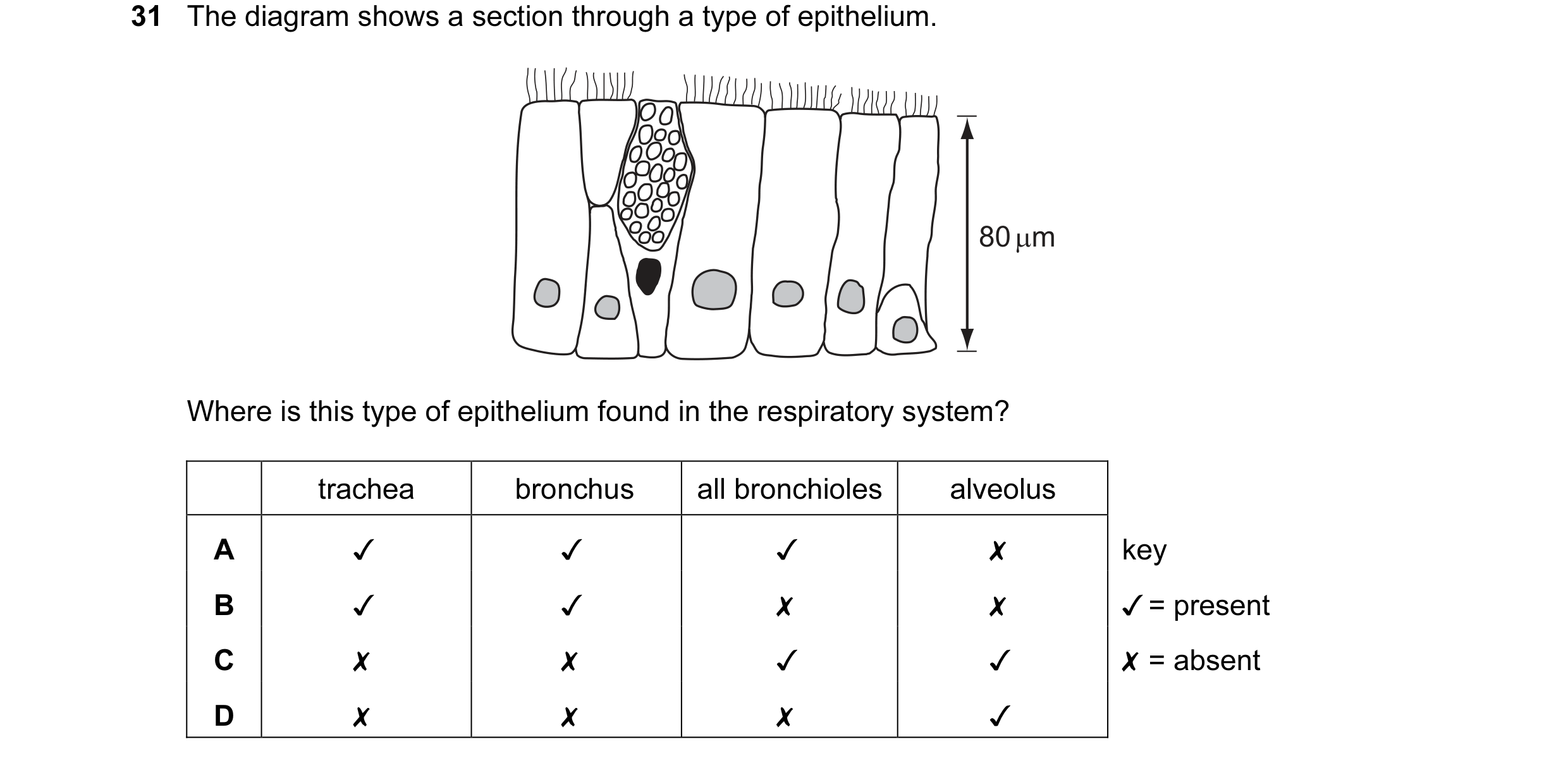 Question 22: The diagram shows a section through a type of epithelium.

Where is this type of epithelium found in the respiratory system?

trachea bronc…