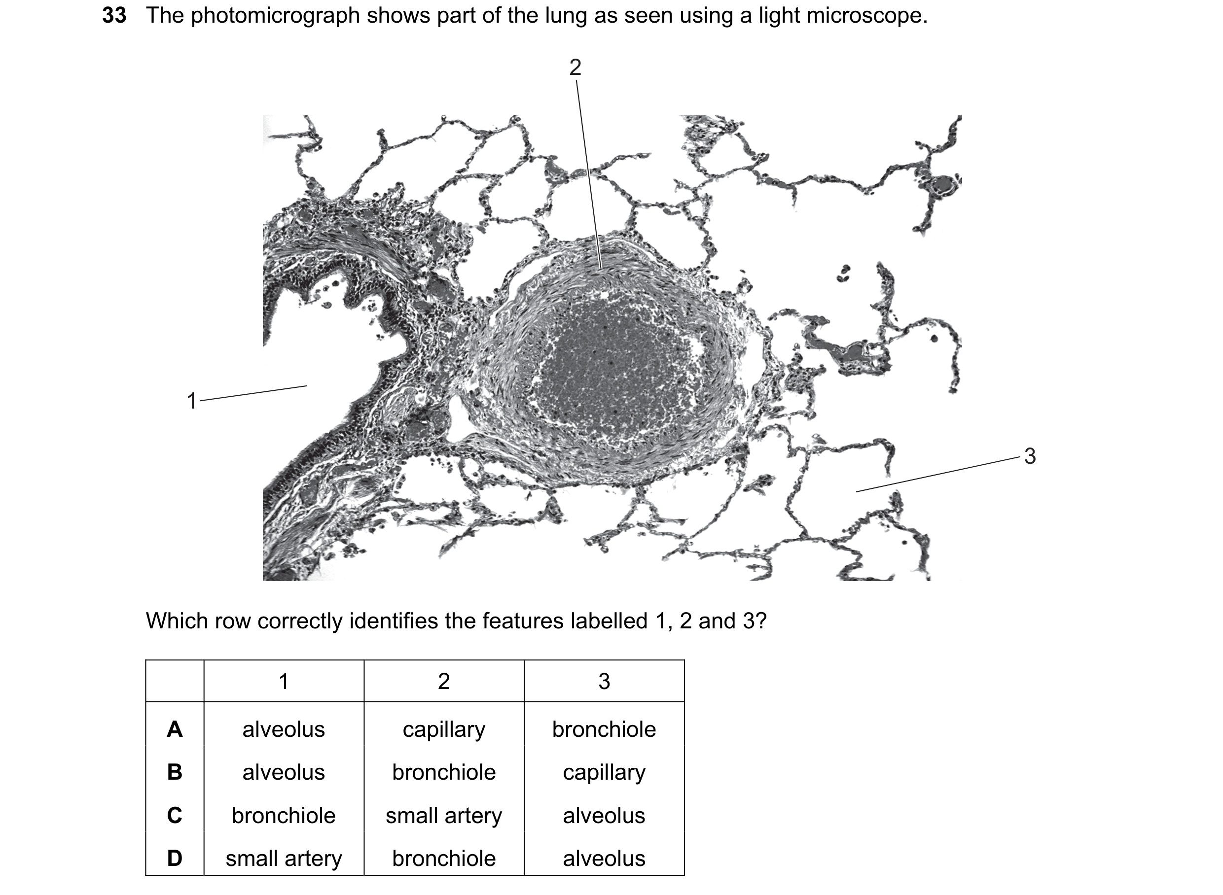 Question 176: The photomicrograph shows part of the lung as seen using a light microscope. 2 1 3 Which row correctly identifies the features labelled 1, …