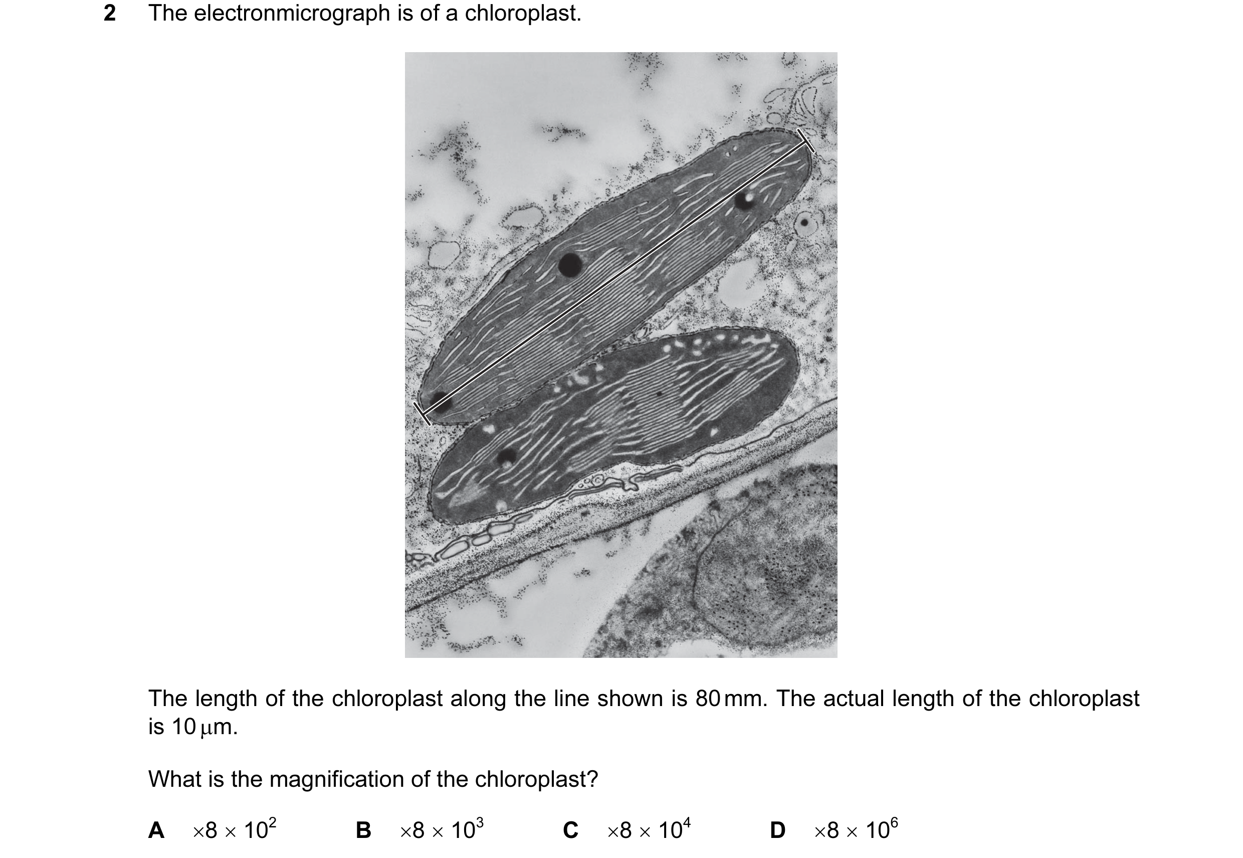 Question 64: The electronmicrograph is of a chloroplast. The length of the chloroplast along the line shown is 80 mm. The actual length of the chloropla…