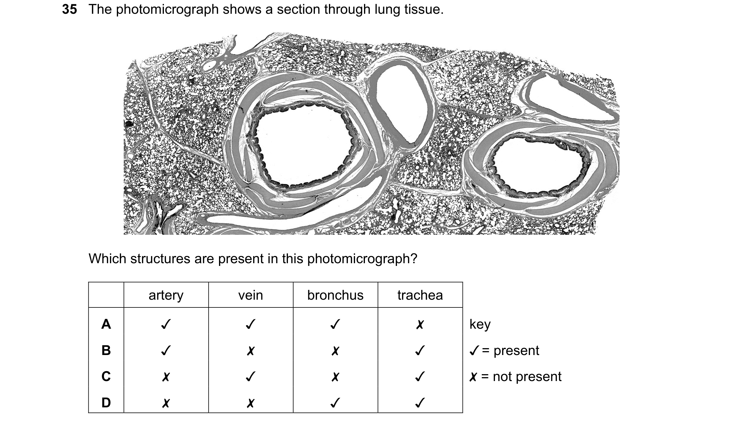 Question 201: The photomicrograph shows a section through lung tissue.
Which structures are present in this photomicrograph?
artery vein bronchus trach…
