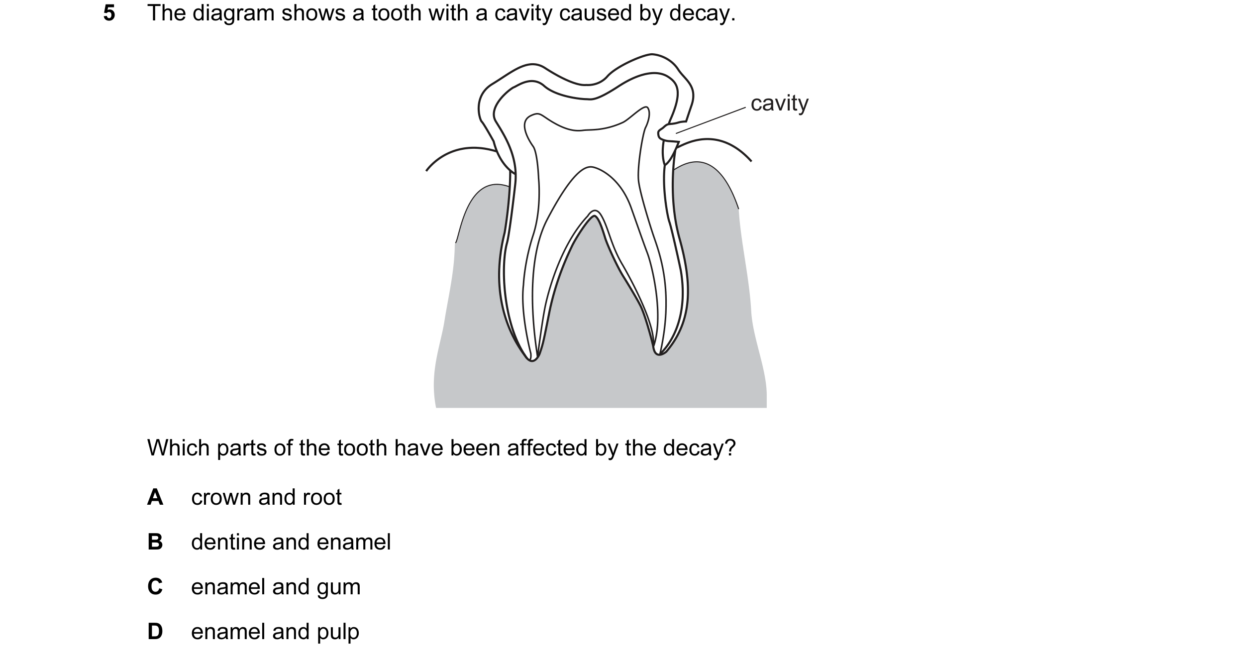 Question 27: The diagram shows a tooth with a cavity caused by decay. cavity Which parts of the tooth have been affected by the decay? A crown and root …